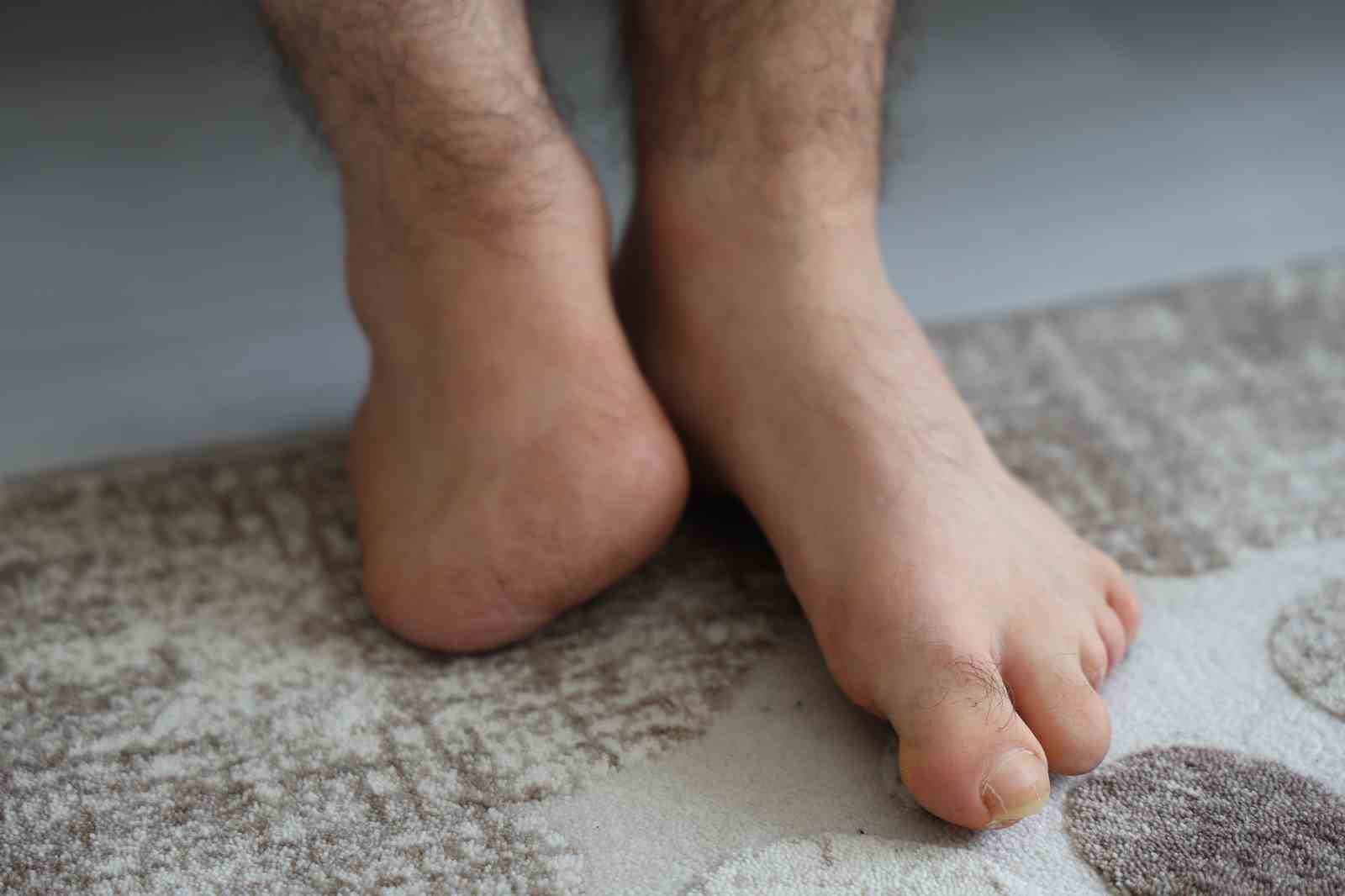 18 günlükken uzuvlarını kaybeden genç azmiyle örnek oluyor
18 günlükken uzuvlarını kaybeden genç azmiyle örnek oluyor