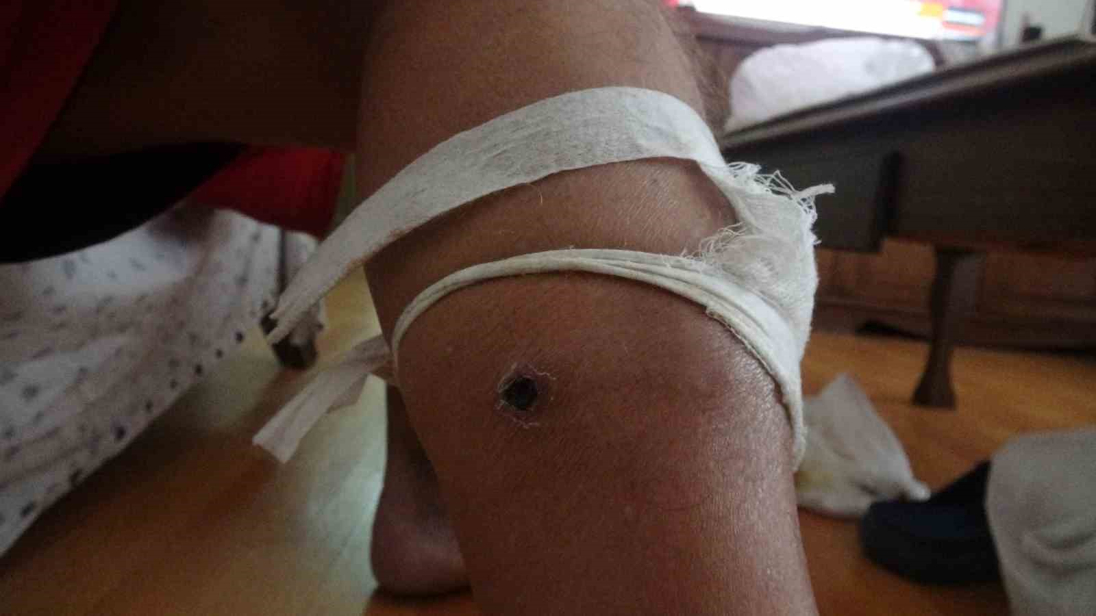 2021 yılından bu yana öz ağabeyi ve yeğeni tarafından 3 kez silahlı saldırıya uğradı
