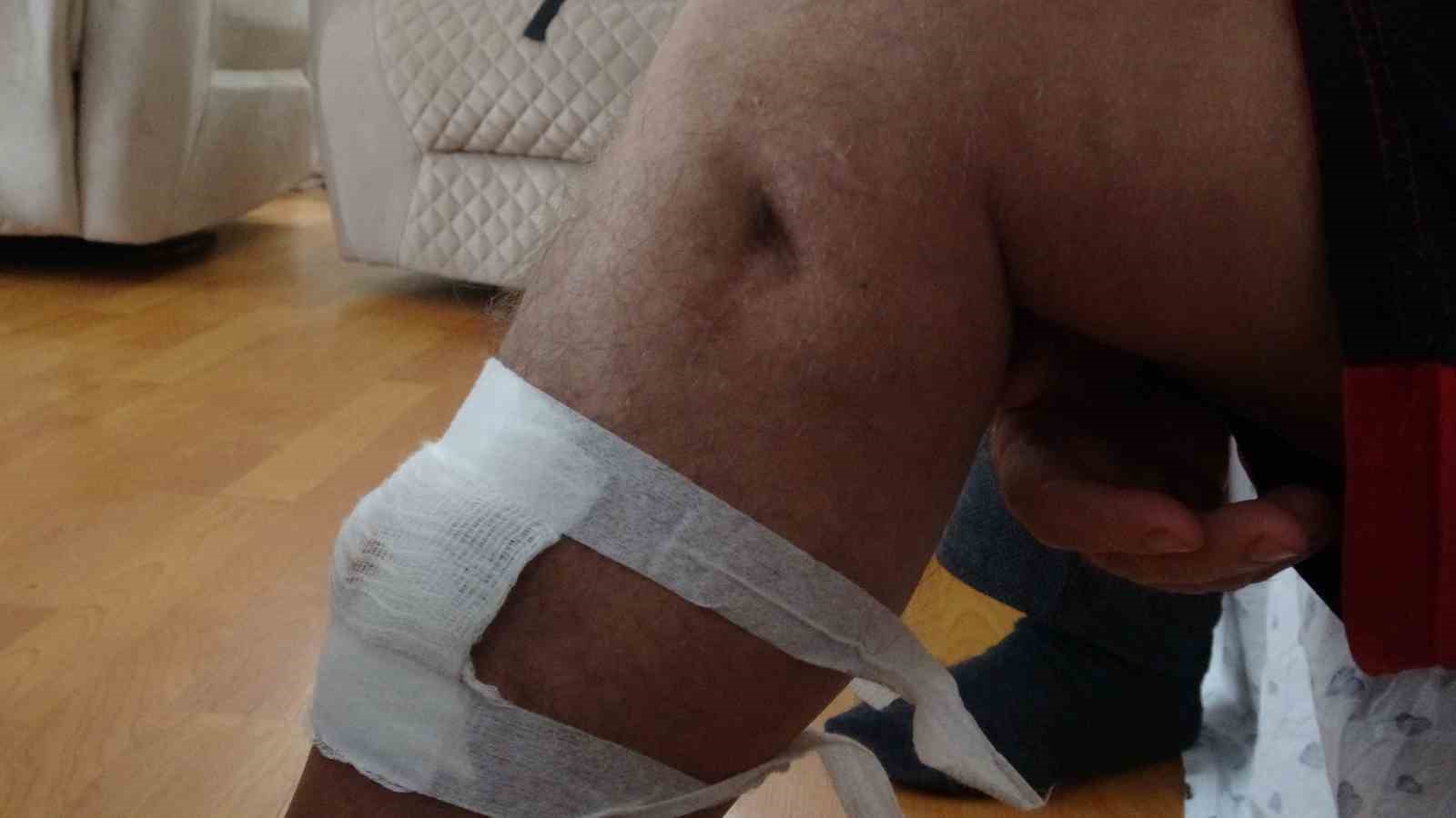 2021 yılından bu yana öz ağabeyi ve yeğeni tarafından 3 kez silahlı saldırıya uğradı
