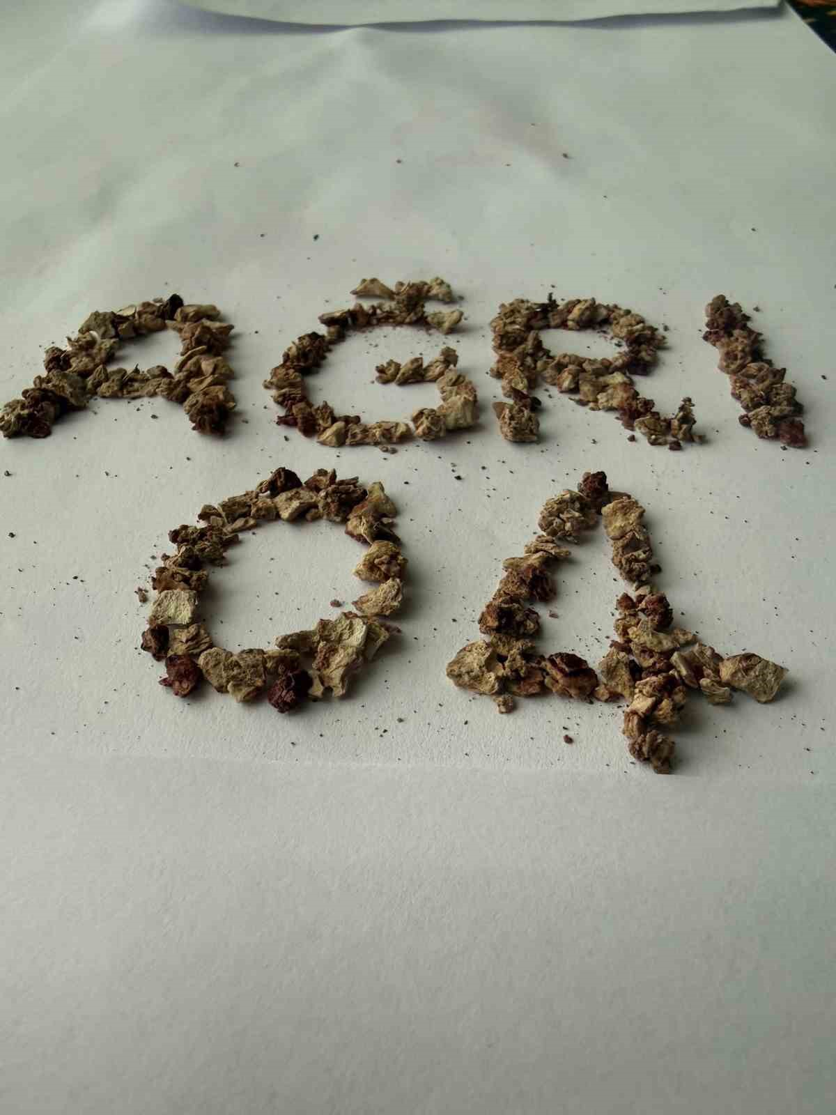 Ağrı’da zorlu taş cerrahisi başarıyla gerçekleştirildi
