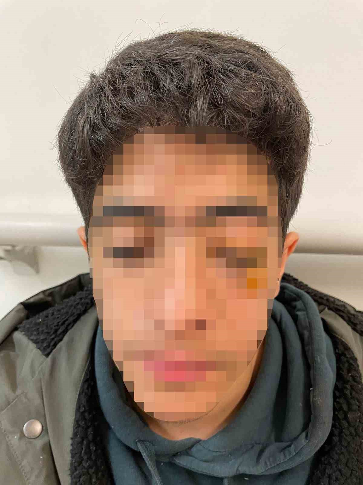 Akran zorbalığına bir yenisi eklendi: 15 yaşındaki çocuk muştayla öldüresiye dövüldü
