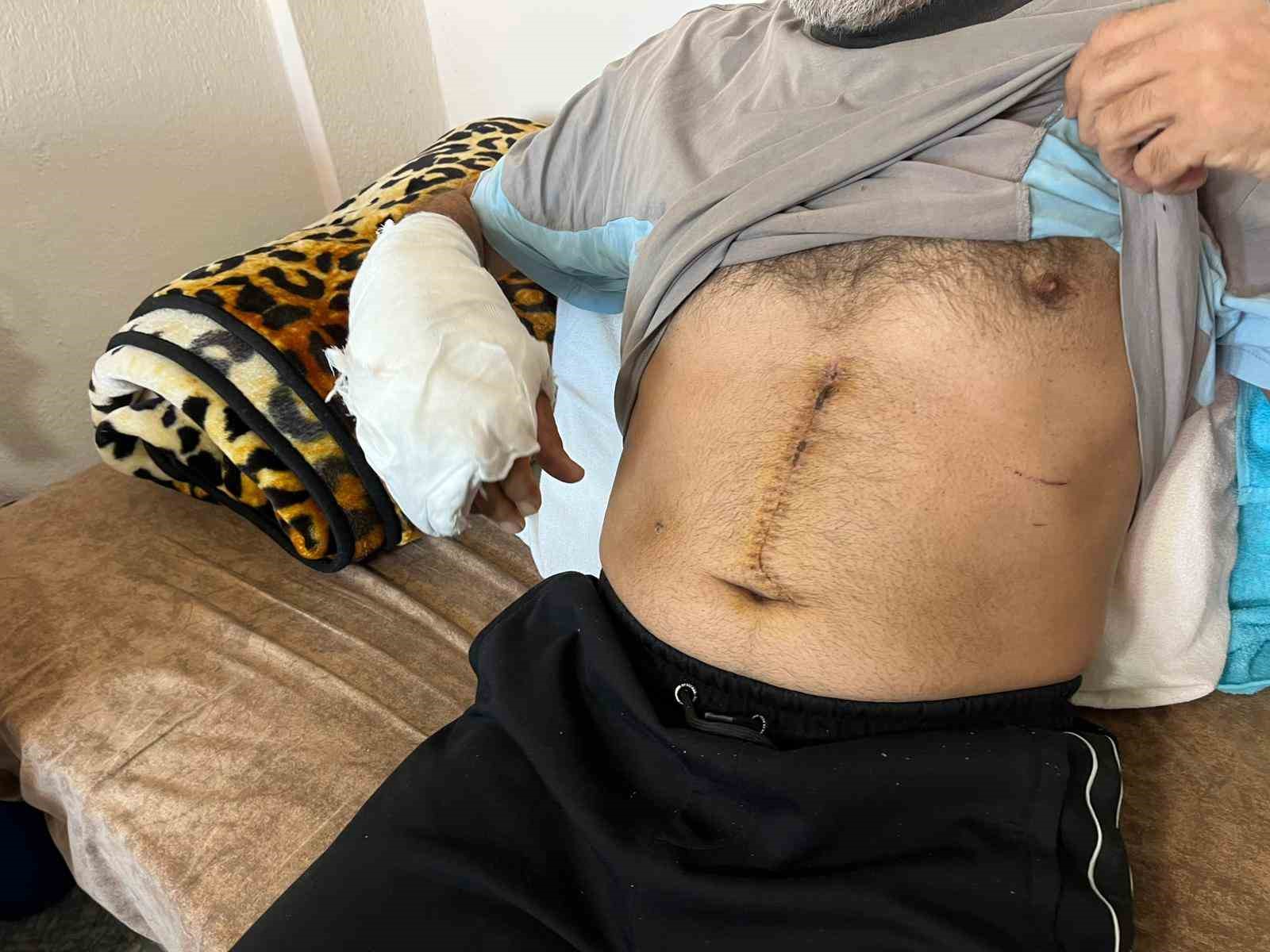 Almanya’dan cinayet için gelmiş: Ablasını öldürdü eniştesini ağır yaraladı
