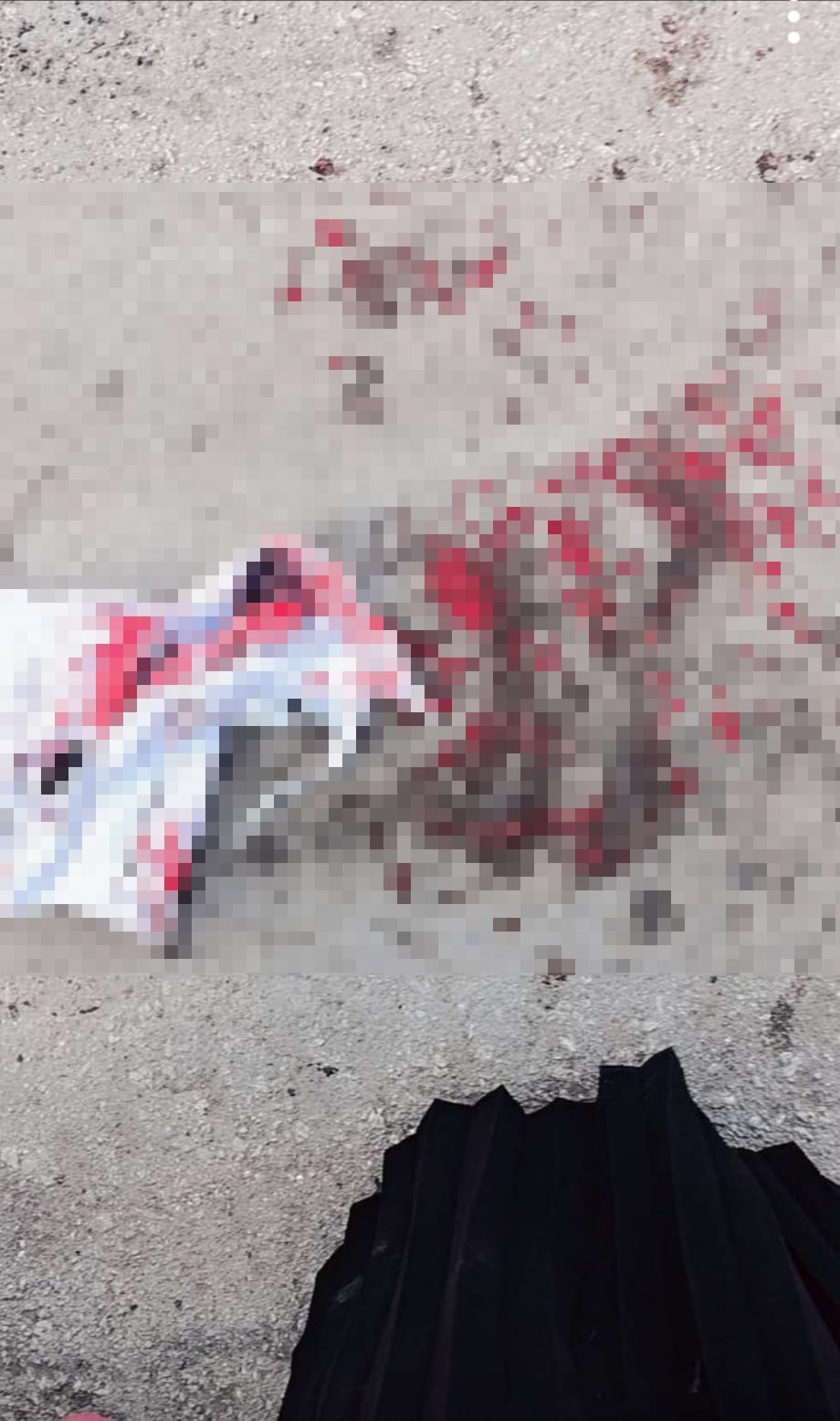 Ankara’da sokak köpeğinin saldırısına uğrayan çocuk yaralandı
