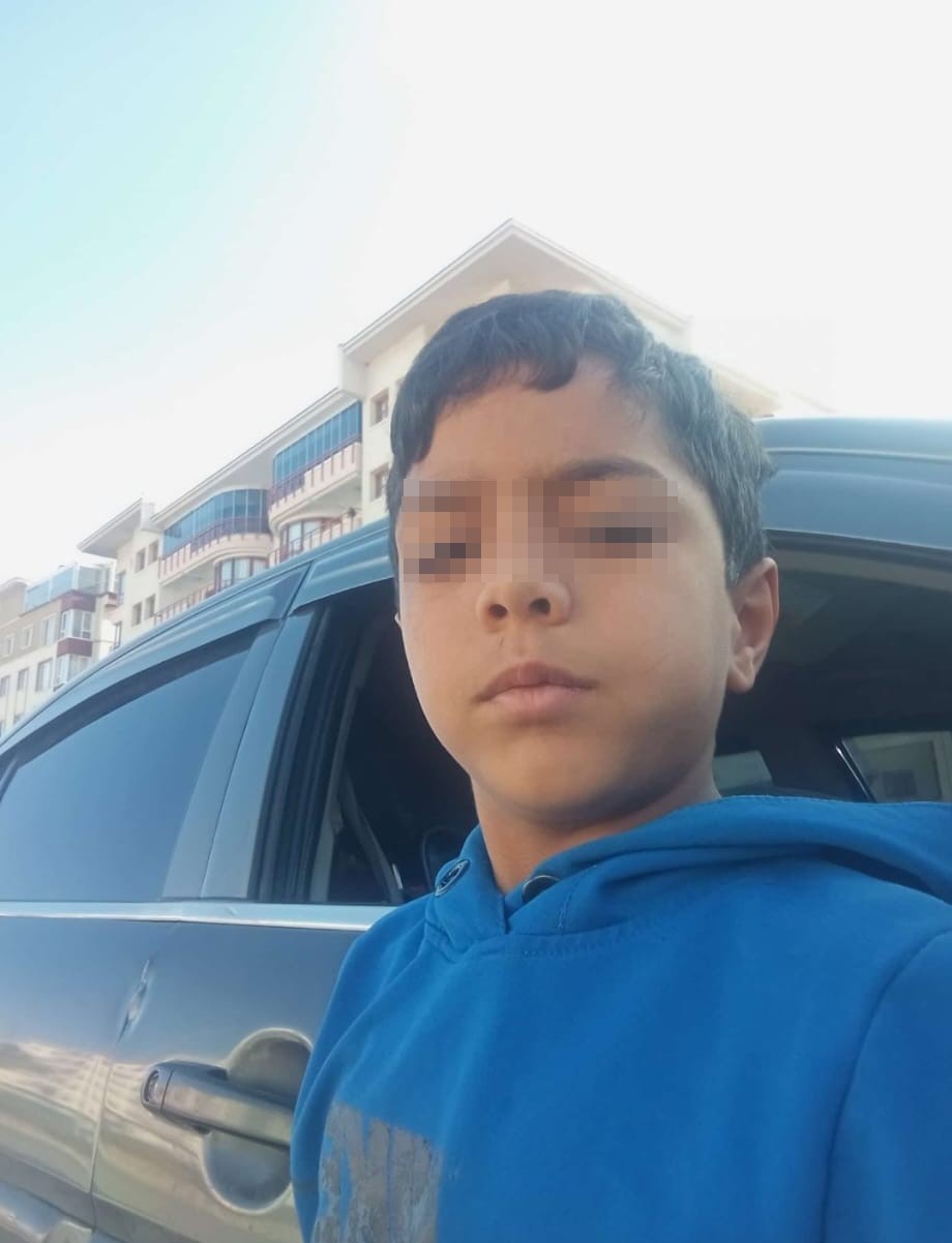 Ankara’da sokak köpeğinin saldırısına uğrayan çocuk yaralandı
