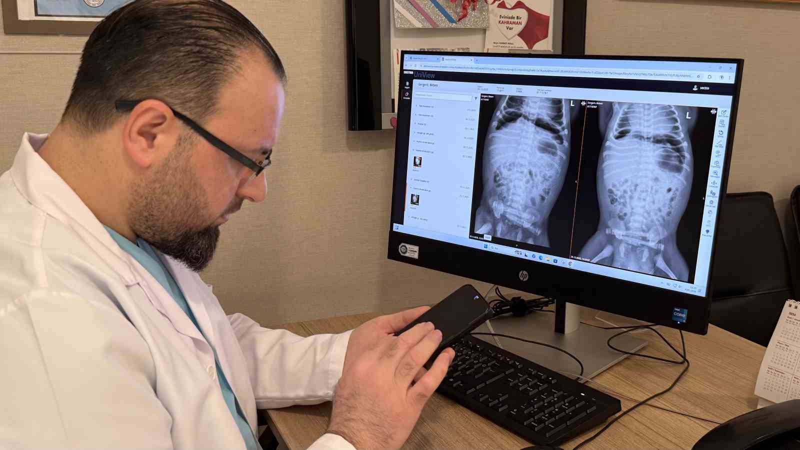 Anne karnındayken milyonda bir görülecek sağlık sorunuyla doğdu
