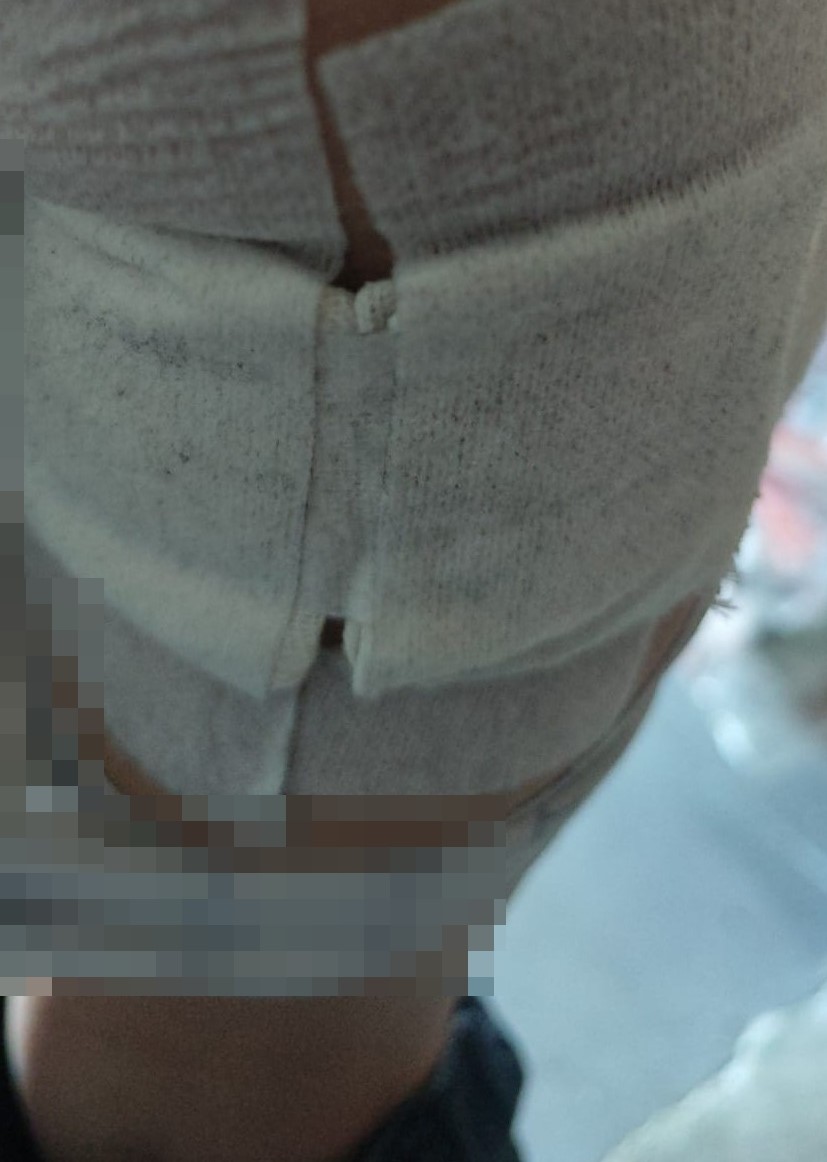 Antalya’da sahipsiz köpeğin saldırısına uğrayan 7 yaşındaki çocuk hastanelik oldu
