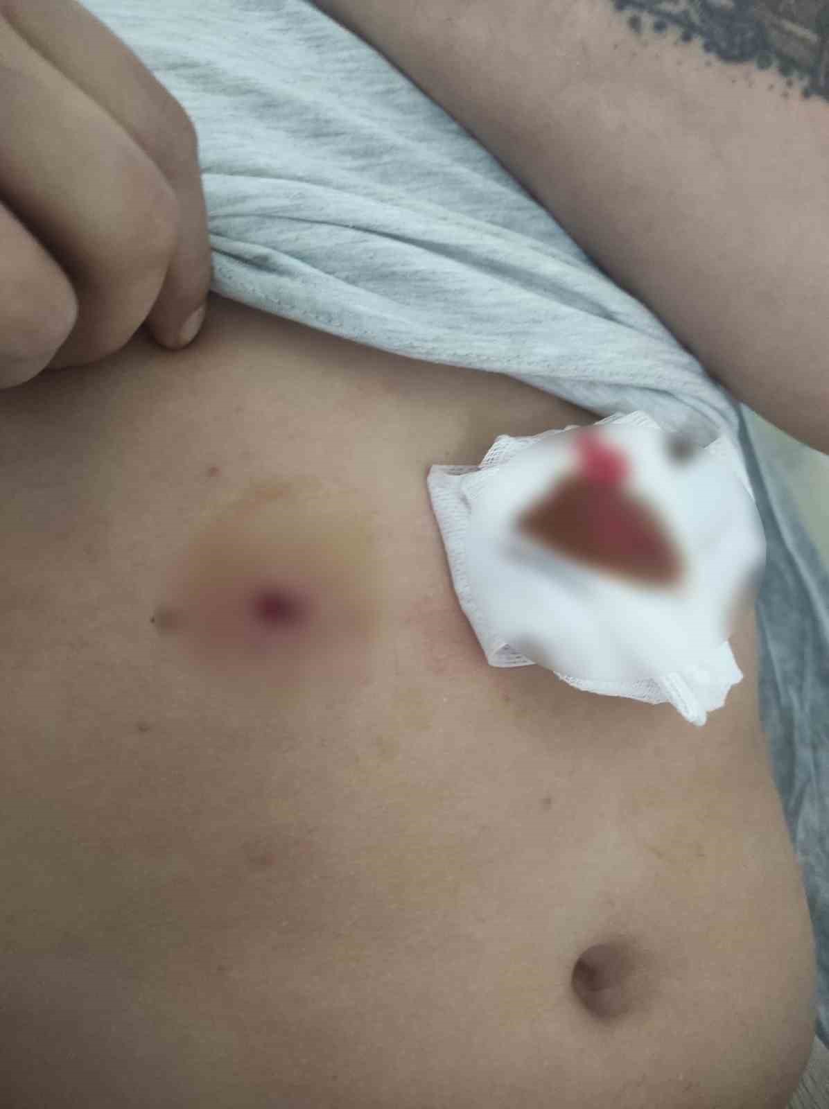 Bandırma’da havalı tüfek kazası: 1 ağır yaralı
