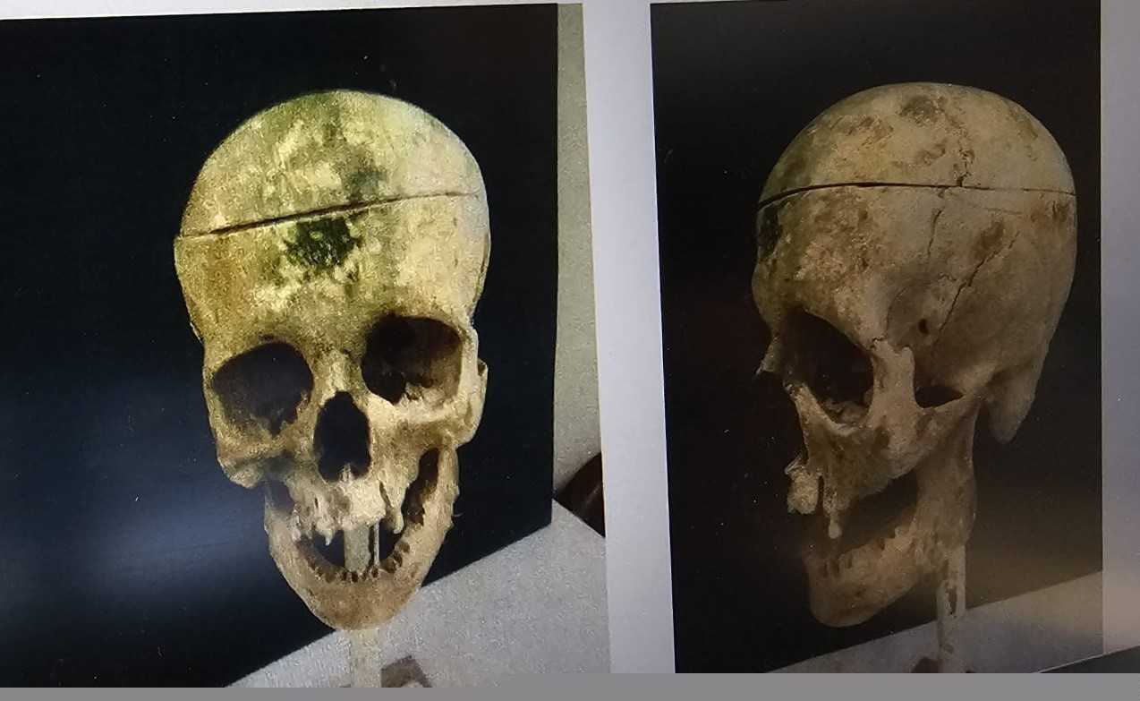 Barajdaki kemiklerle 18 yıllık cinayetin sırrı çözüldü
