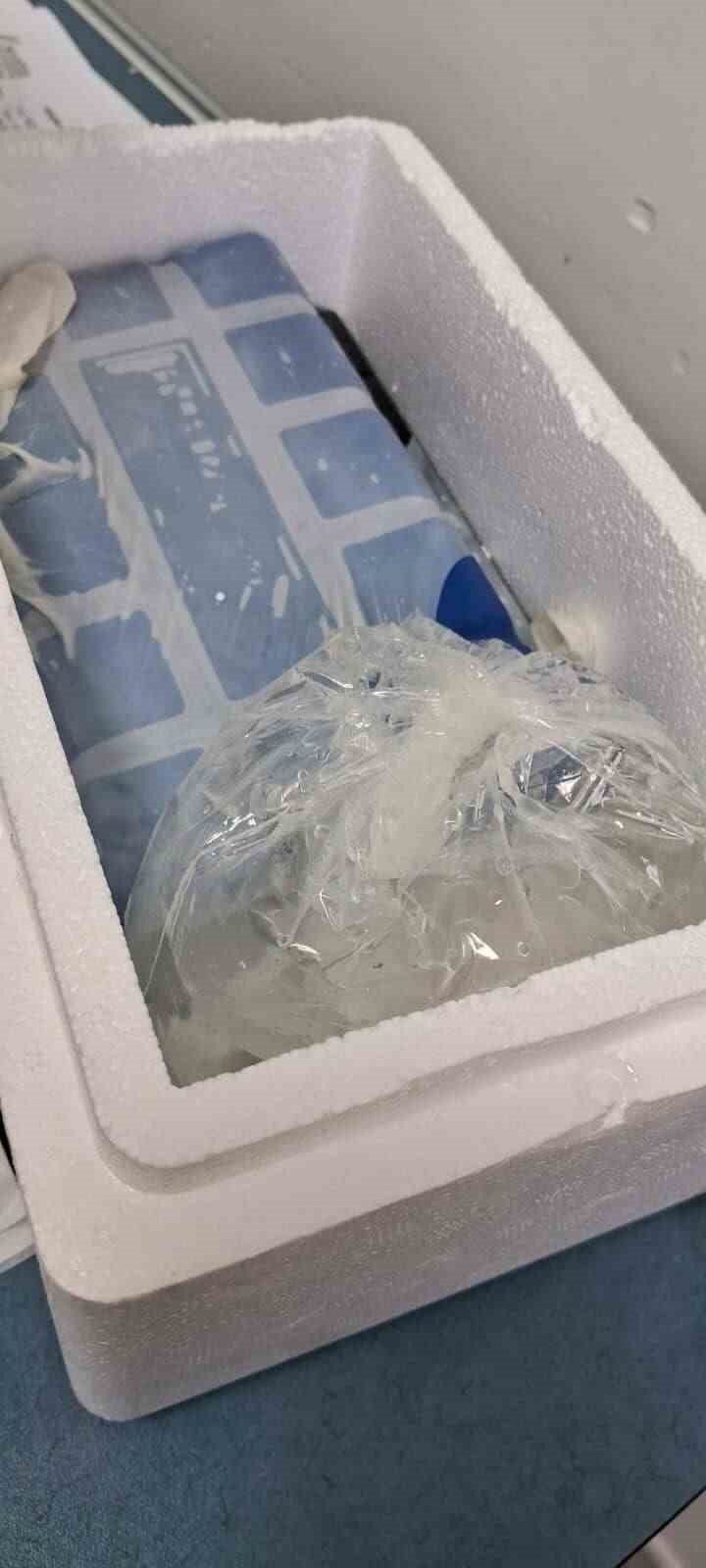 Başıboş köpeklerin saldırısına uğrayan adamın baş parmağı koptu
