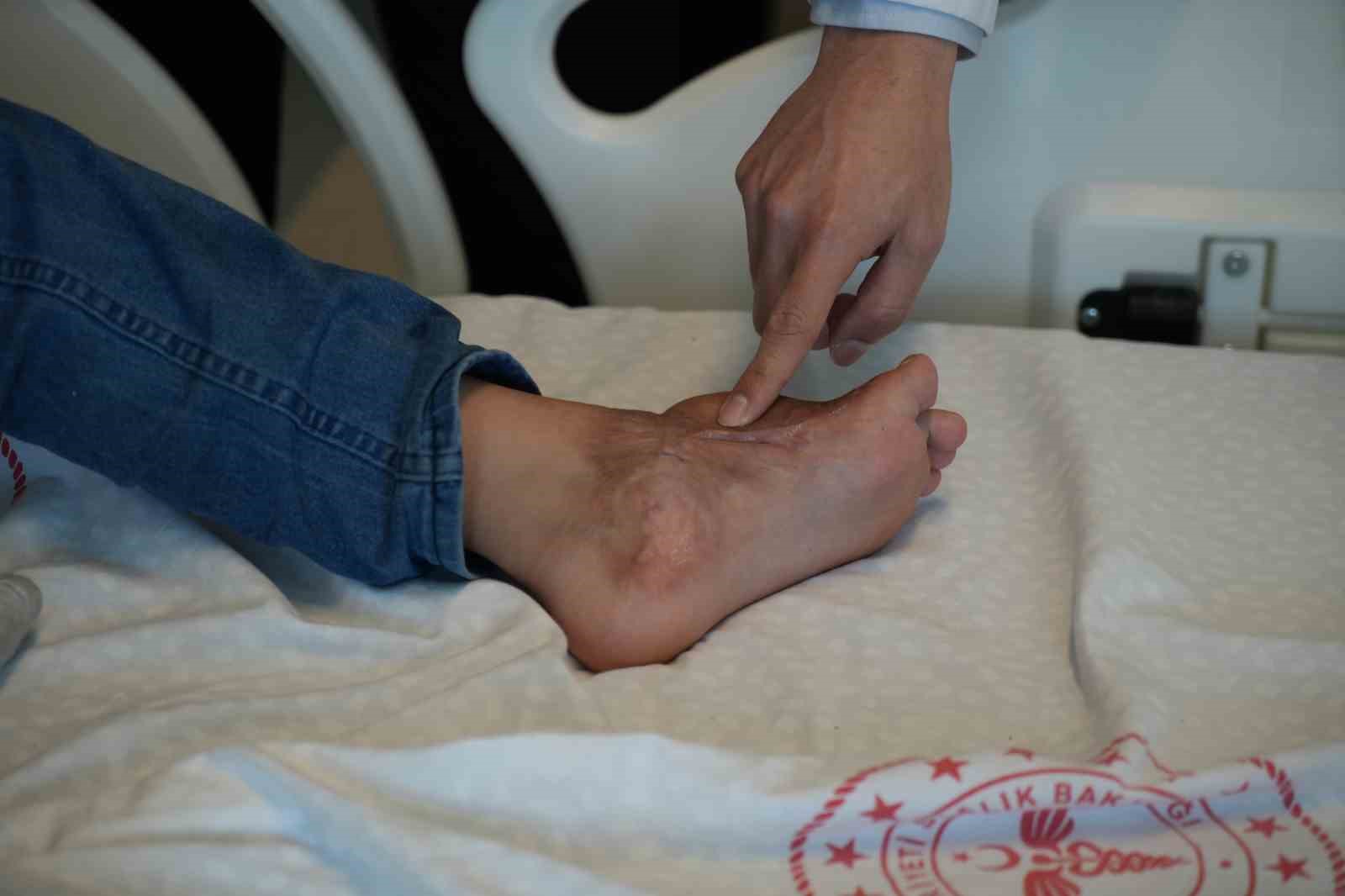 Başparmağında ileri derece hareket kısıtlılığı olan çocuk, operasyonla sağlığına kavuştu
