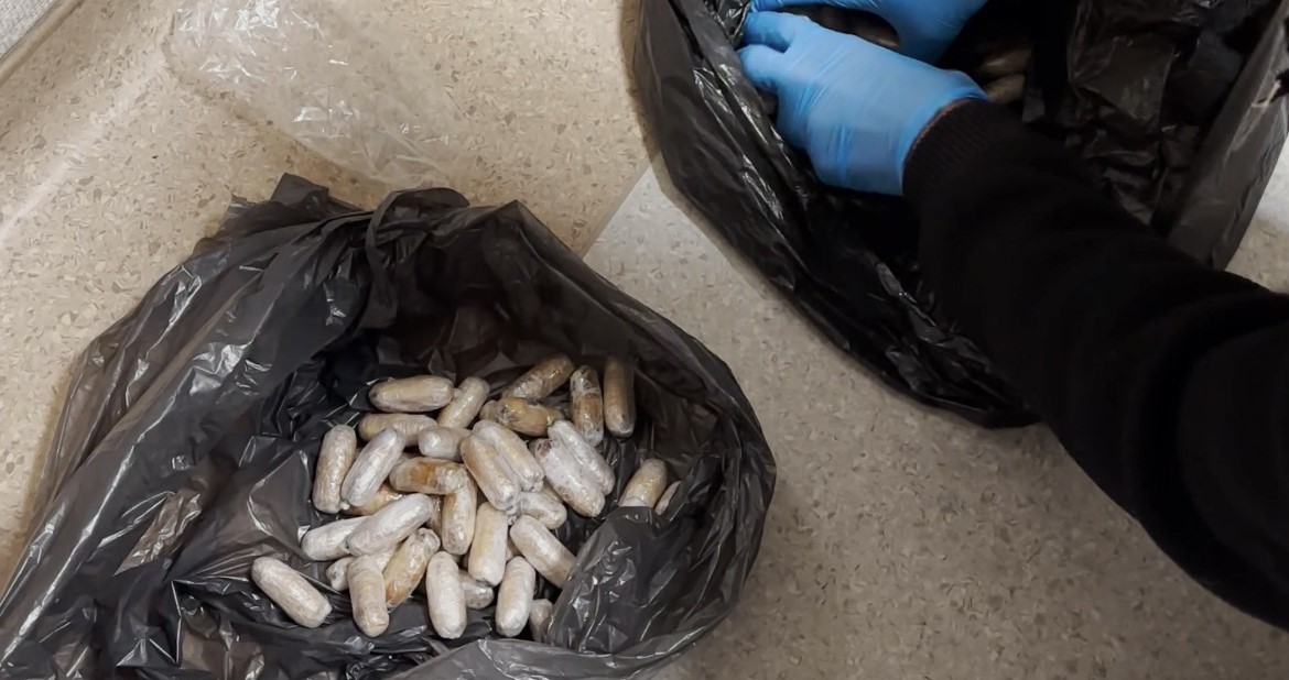 Batman’da yabancı uyruklu bir  şahsın midesinden 64 parça uyuşturucu çıktı
