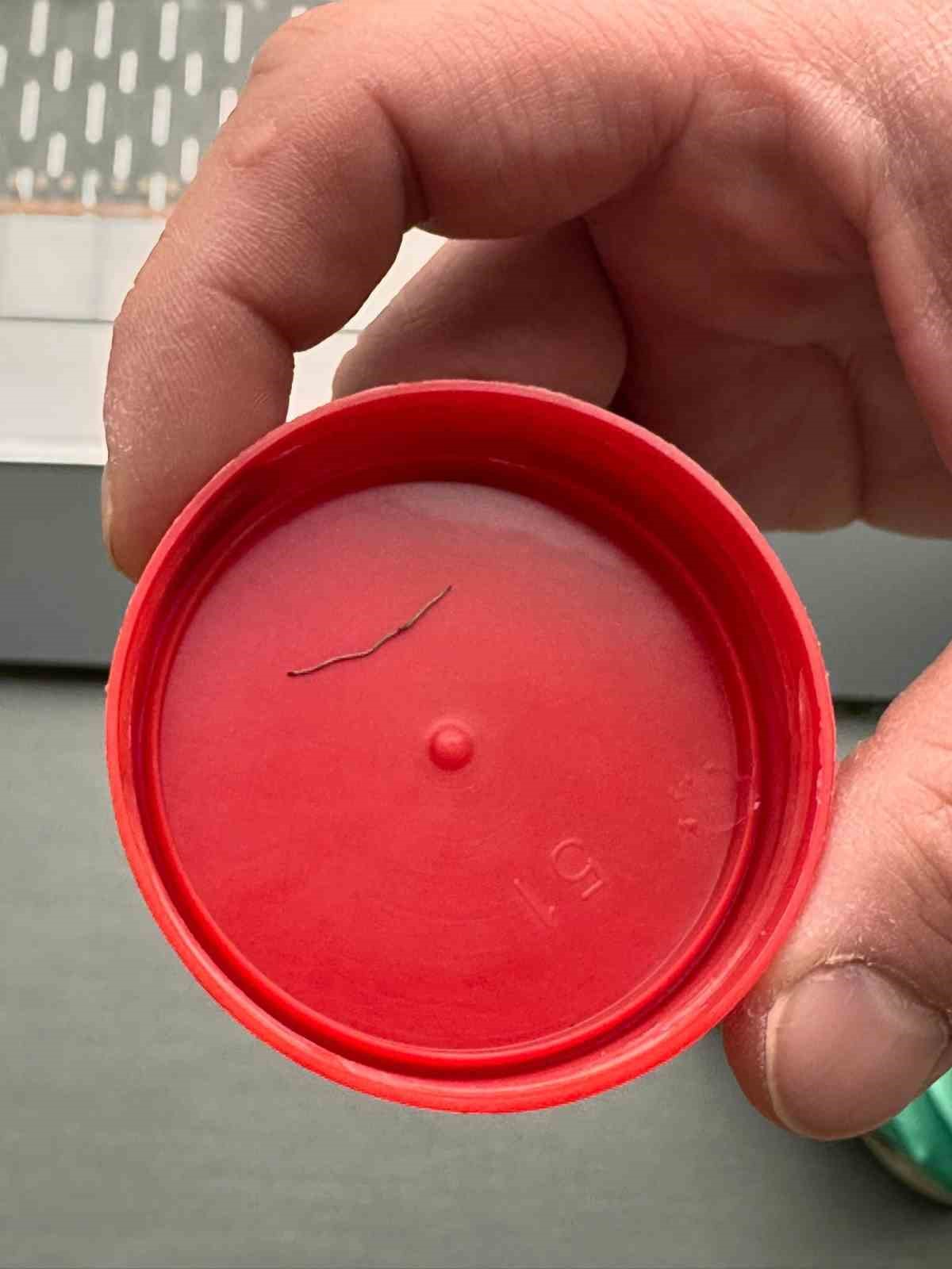 Bebeğin sırtından tel parçası çıktı
