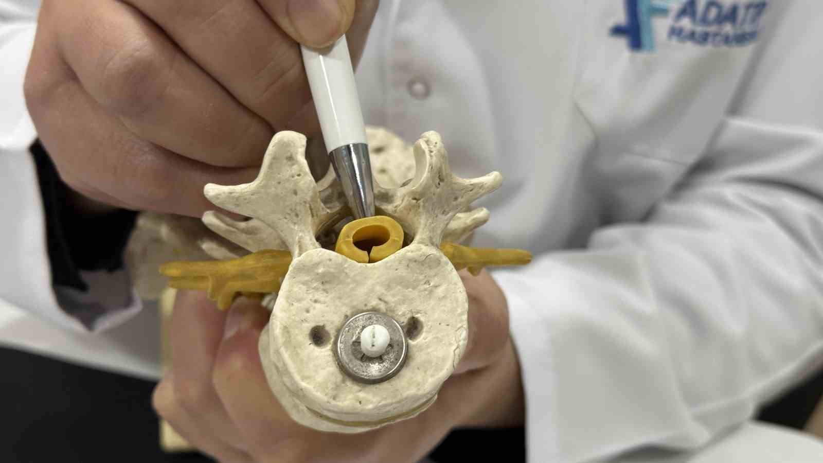 Beldeki gizli tehlike: Spinal stenoz
