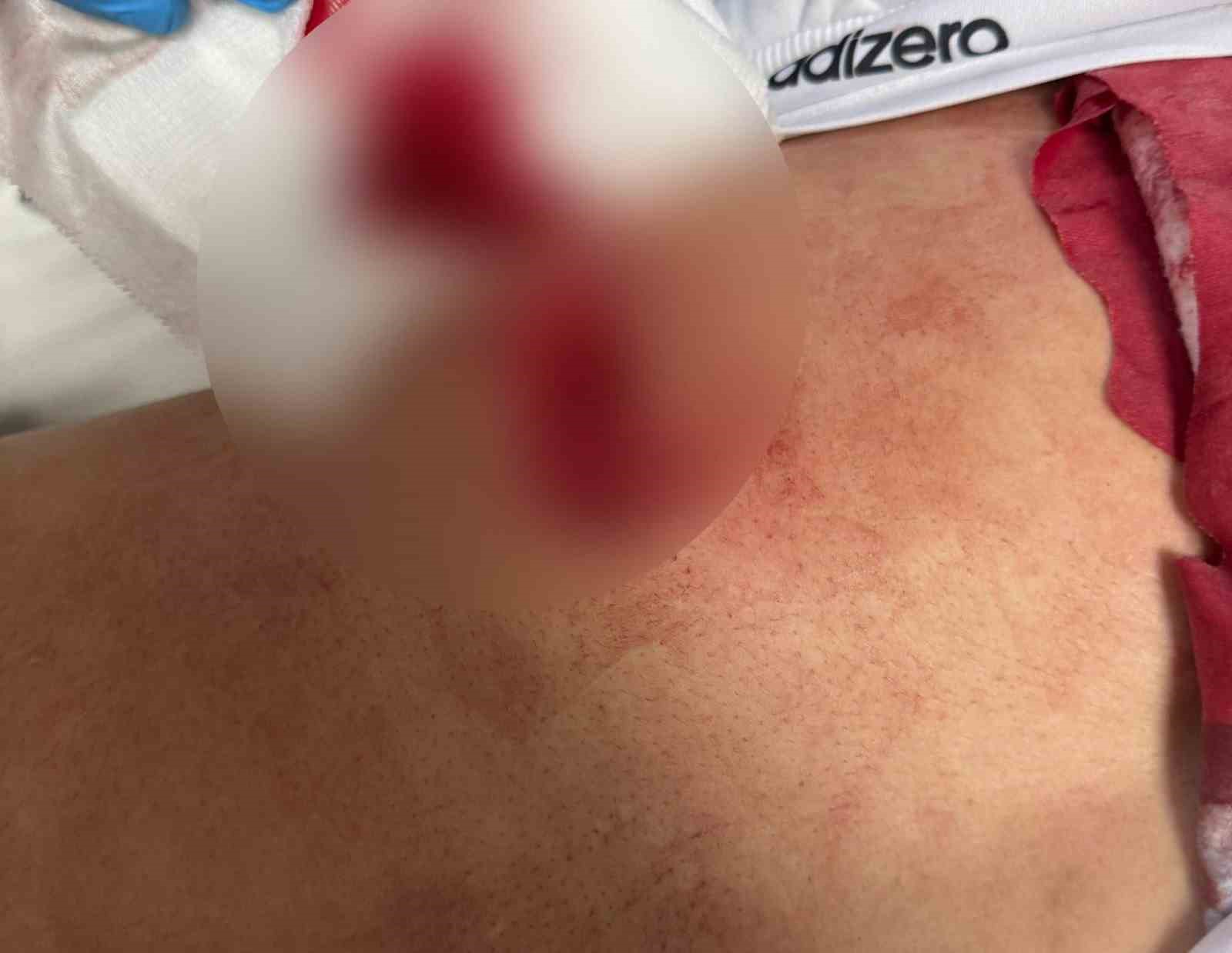 Bursa’da parkta çıkan tartışmada kan aktı, sırtından bıçaklanarak yaralandı
