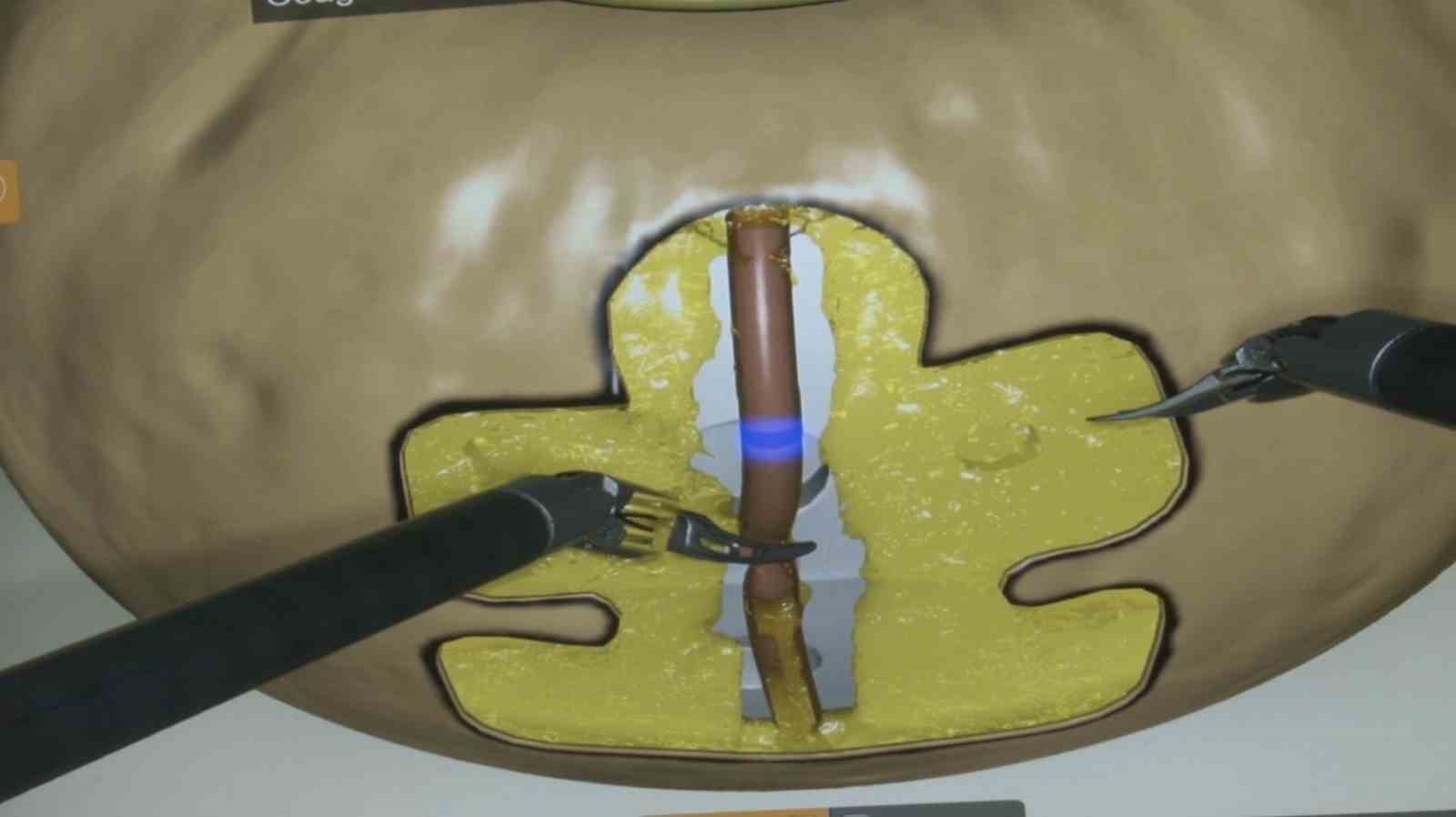 Bursa’da robotik ameliyat uygulamaları başladı
