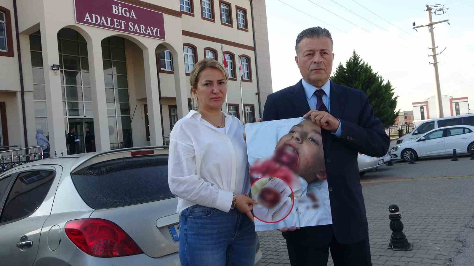 Çanakkale’de çenesine demir saplanan öğrencinin davasının 2’nci duruşması görüldü
