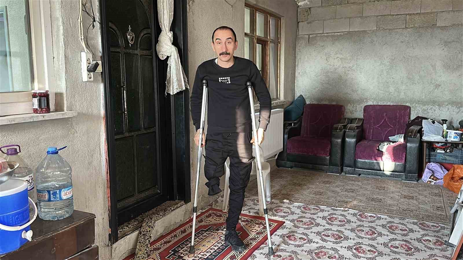 Çapa makinesi kaptırdığı bacağını kaybeden babanın en büyük isteği kızıyla birlikte gezebilmek
