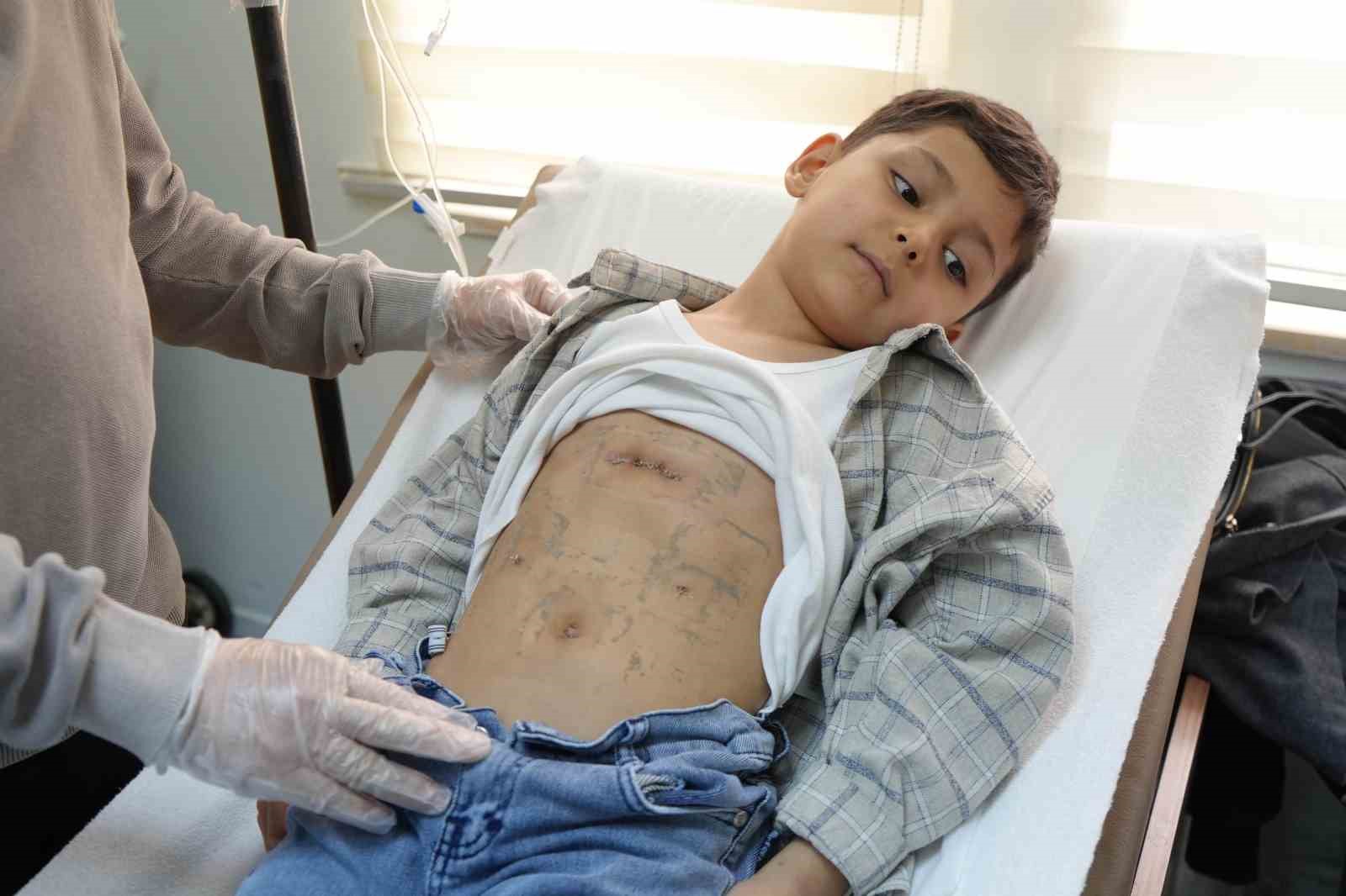 Çocuklarda nadir görülen diyafram fıtığı Samsun’da ilk kez tedavi edildi
