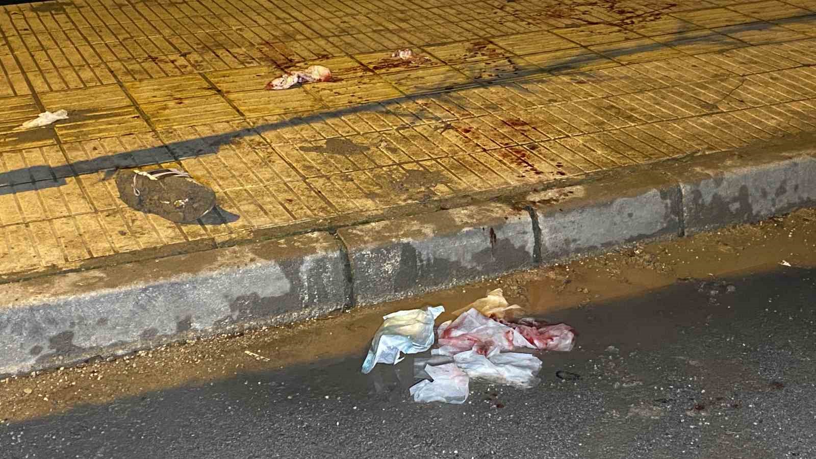 Çorum’da bıçaklı kavga: 1 yaralı
