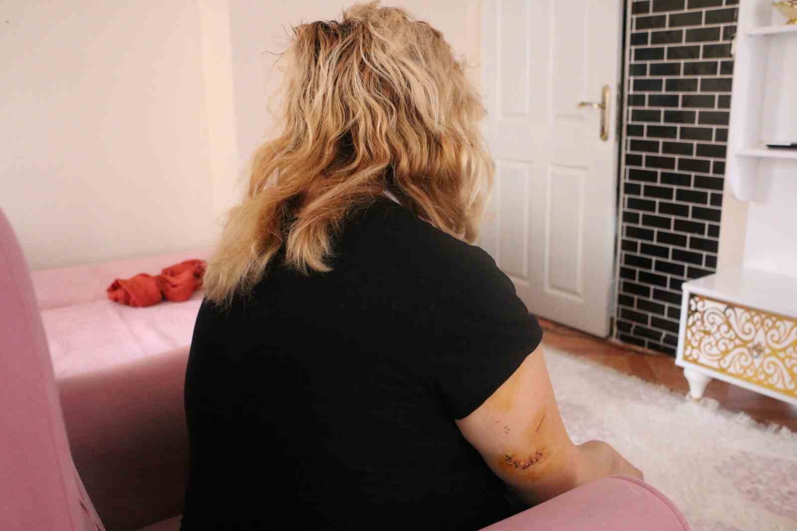 Diyarbakır’da dehşet: Nikahlı eşini 30 yerinden bıçakladı
