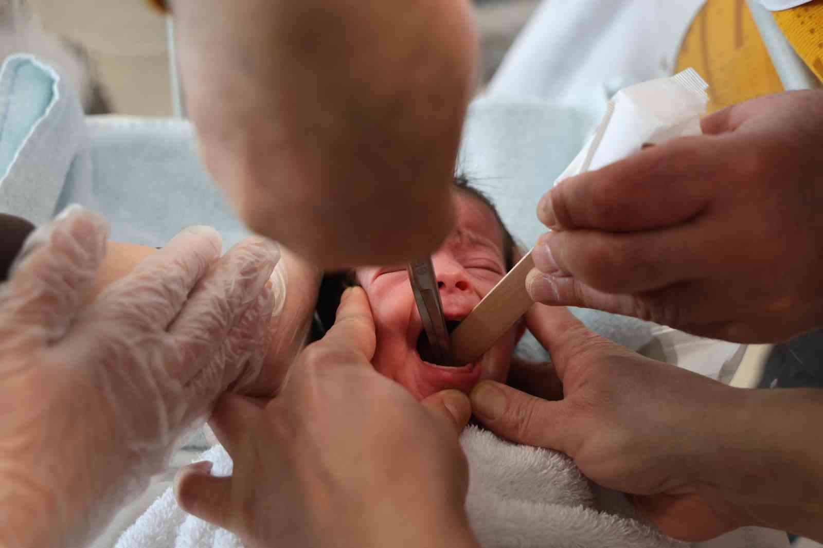 Doğuştan yemek borusu olmayan 4 günlük bebek, Elazığ’da hayata tutundu
Doğuştan yemek borusu olmayan 4 günlük bebek, Elazığ’da hayata tutundu