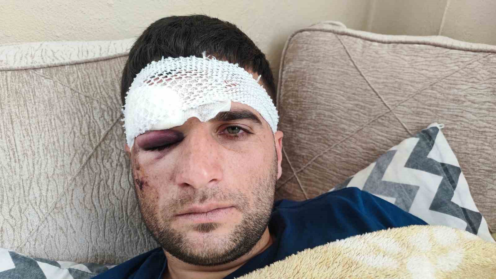 Döner ustası motosiklet sürücüsü: "Kaza sonrası kaçıp gittiler"
Döner ustası motosiklet sürücüsü: "Kaza sonrası kaçıp gittiler"