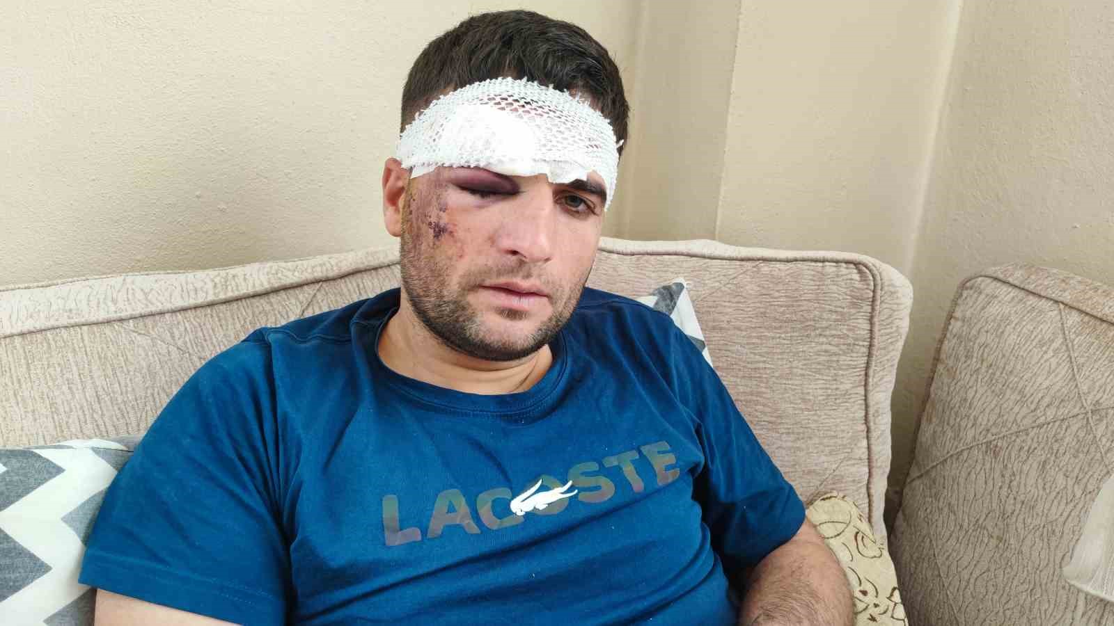 Döner ustası motosiklet sürücüsü: "Kaza sonrası kaçıp gittiler"
Döner ustası motosiklet sürücüsü: "Kaza sonrası kaçıp gittiler"