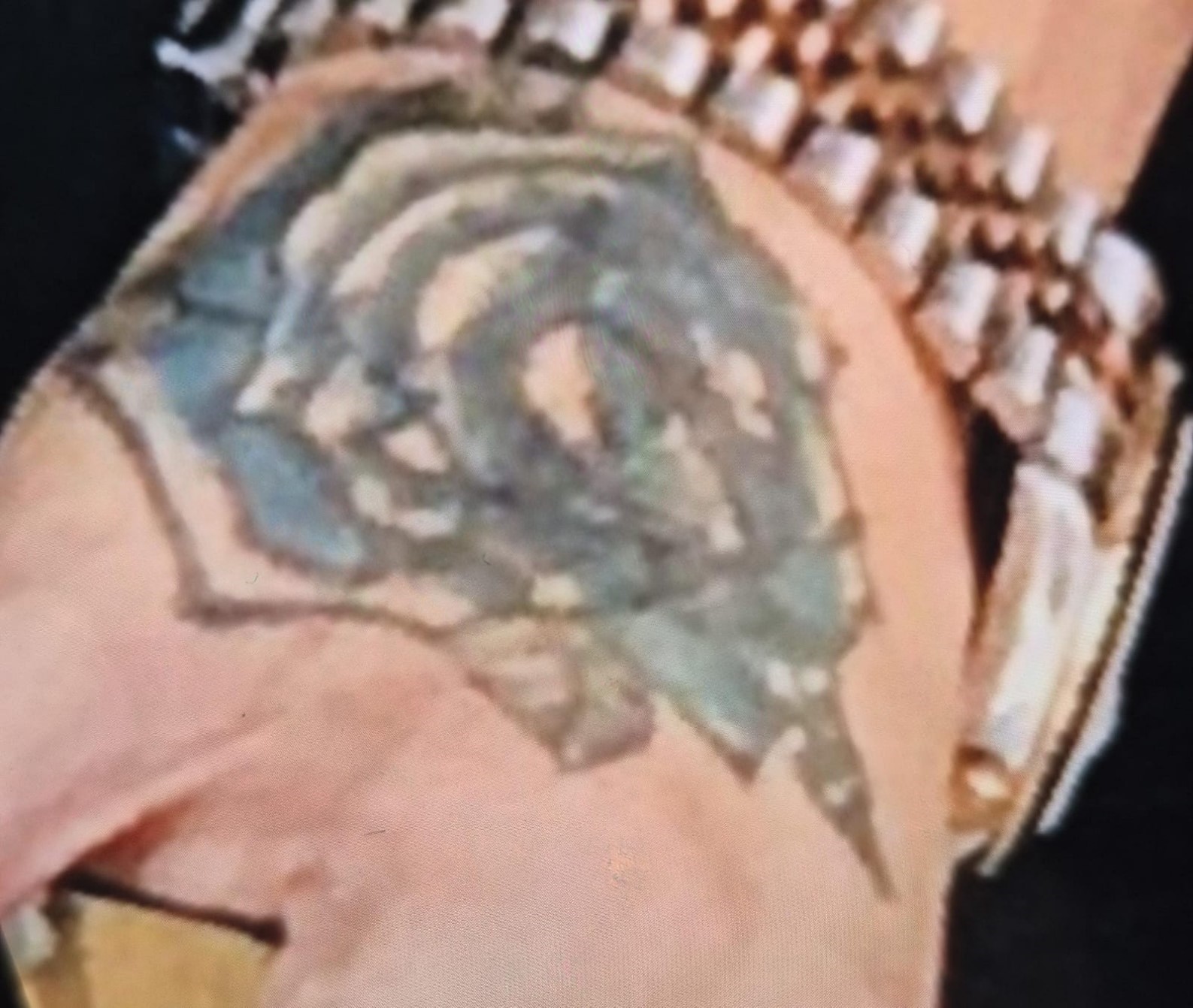 Dövme sildirmek isterken kabusu yaşadı, elindeki dokular öldü
