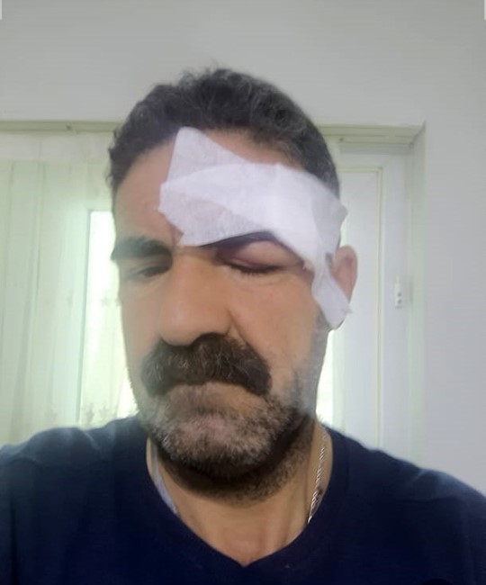 Elazığ’daki kavga, tuvaletini duvara yapan yolcu nedeniyle çıkmış
