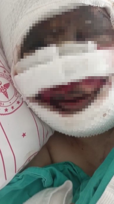 Eski eşi tarafından vahşete uğrayan kadın o anları anlattı, acılı baba sert tepki gösterdi
Eski eşi tarafından vahşete uğrayan kadın o anları anlattı, acılı baba sert tepki gösterdi