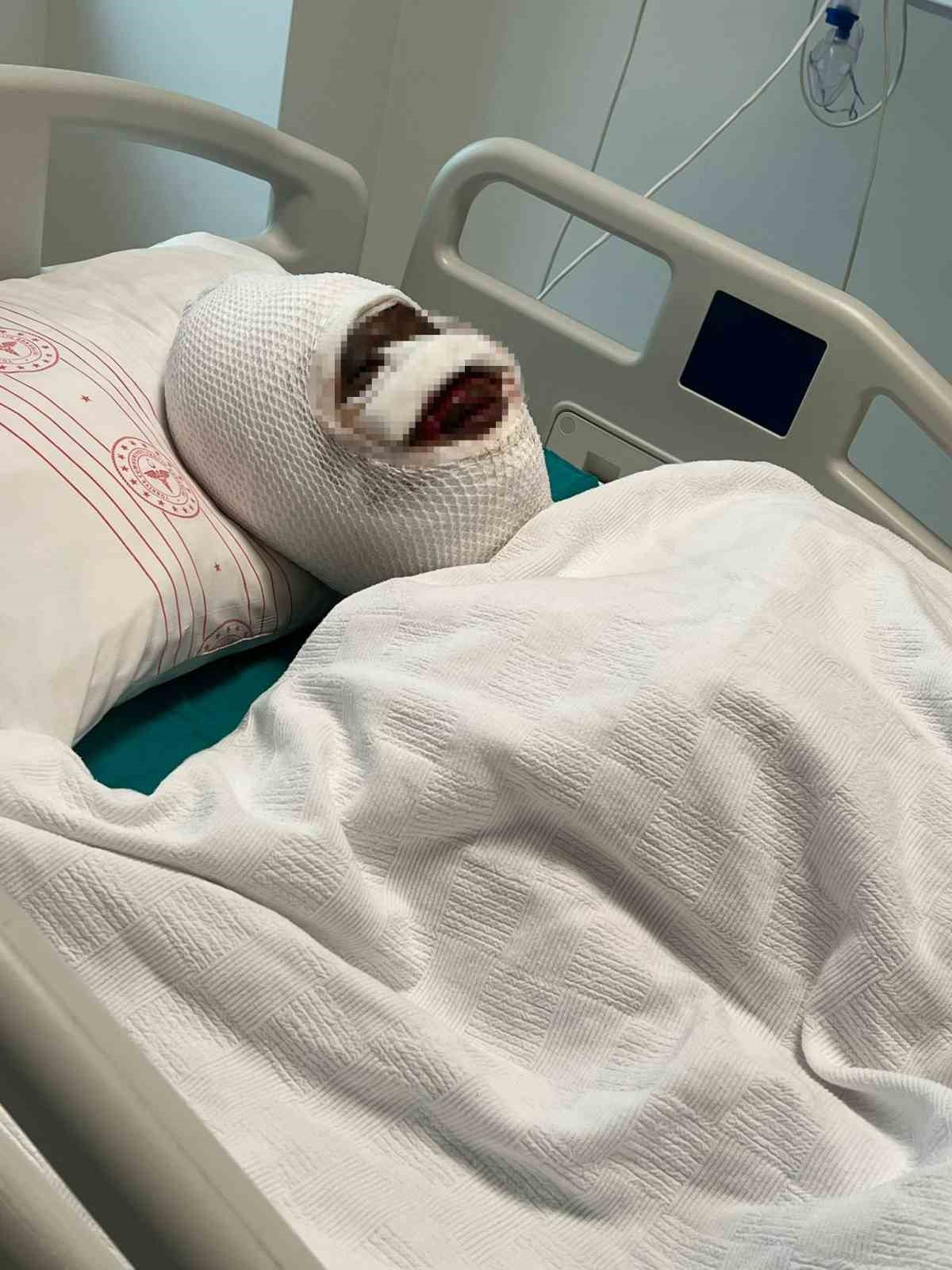 Eski eşi tarafından vahşete uğrayan kadın o anları anlattı, acılı baba sert tepki gösterdi
Eski eşi tarafından vahşete uğrayan kadın o anları anlattı, acılı baba sert tepki gösterdi