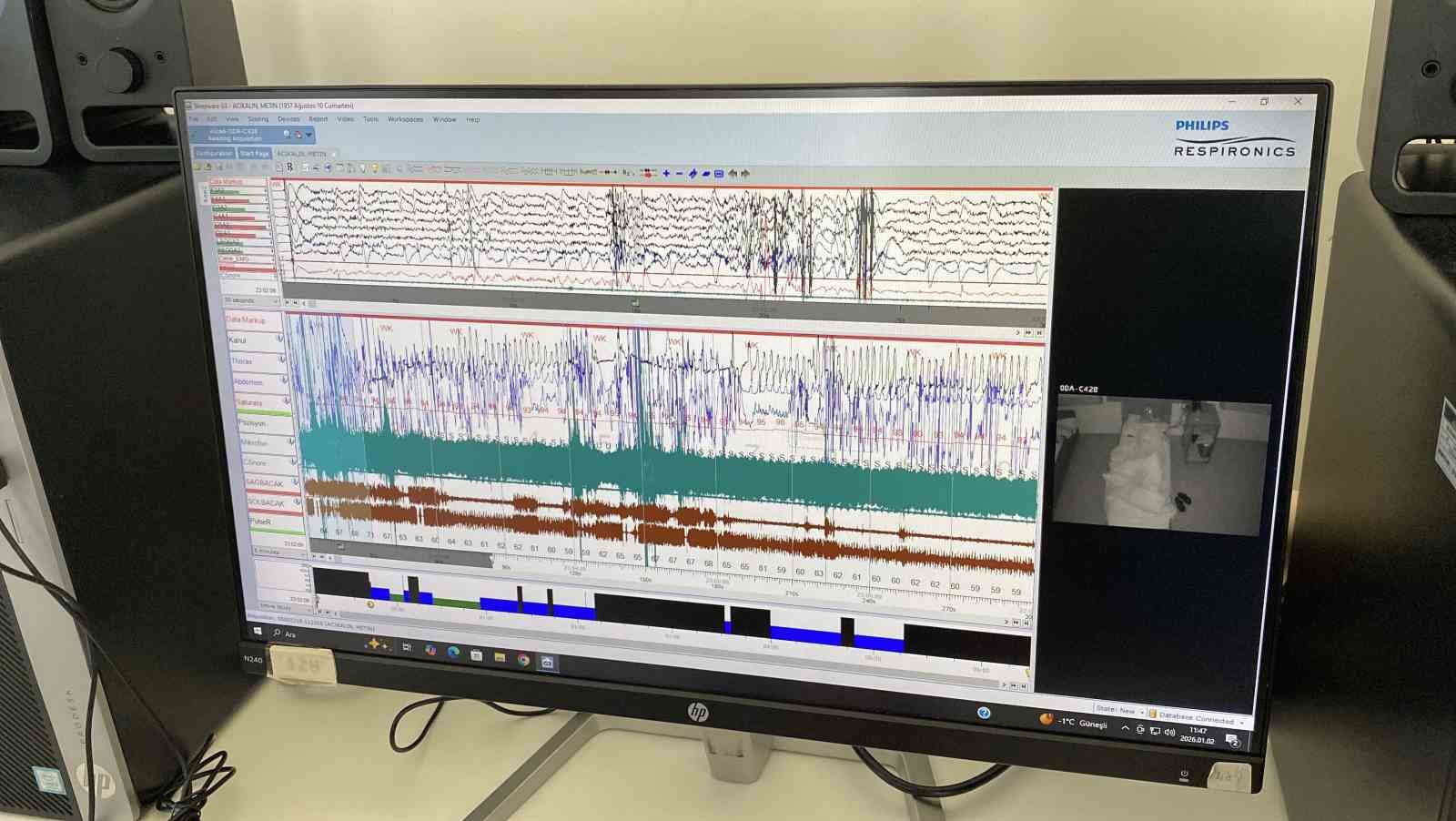 Eskişehir Şehir Hastanesi’nde nöroloji hastalarına ileri tedavi imkanları sunuluyor
Eskişehir Şehir Hastanesi’nde nöroloji hastalarına ileri tedavi imkanları sunuluyor