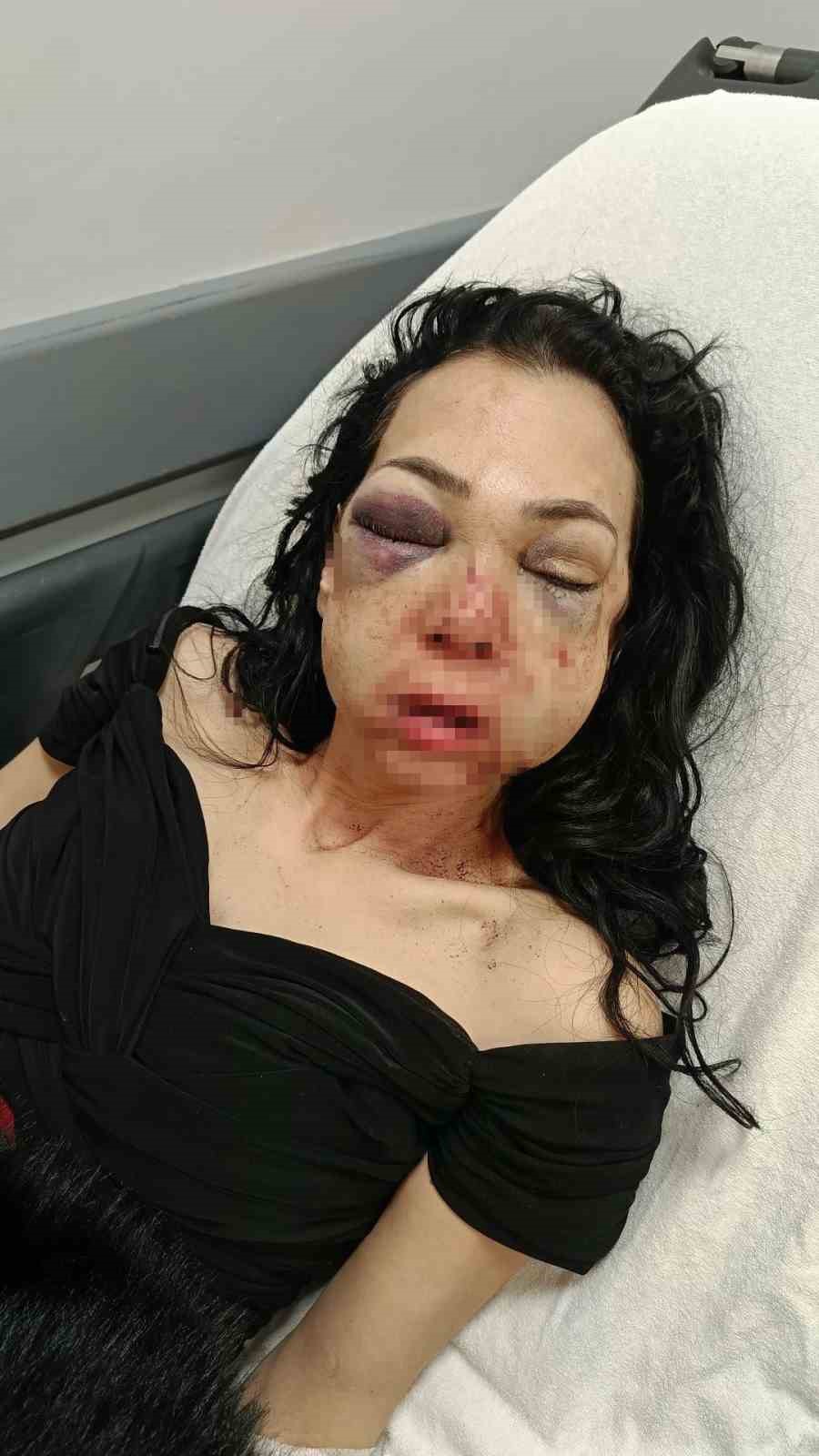 Feci şekilde darp edilmişti, yaşadığı dehşeti unutamıyor
