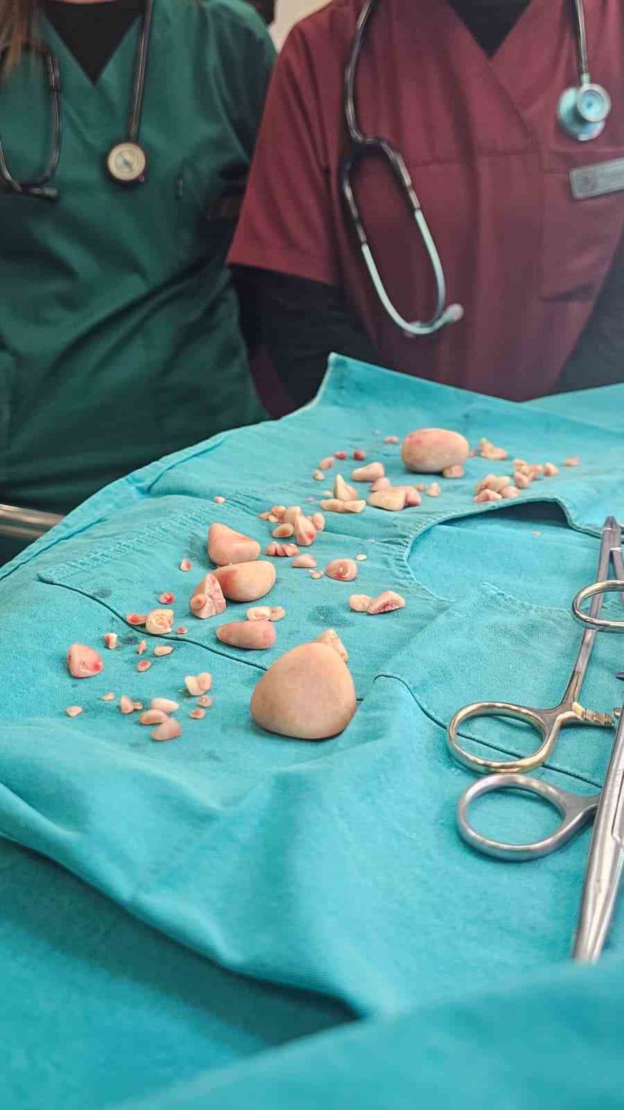 Görenler gözlerine inanamadı: Köpeğin karnından 140 taş çıktı
