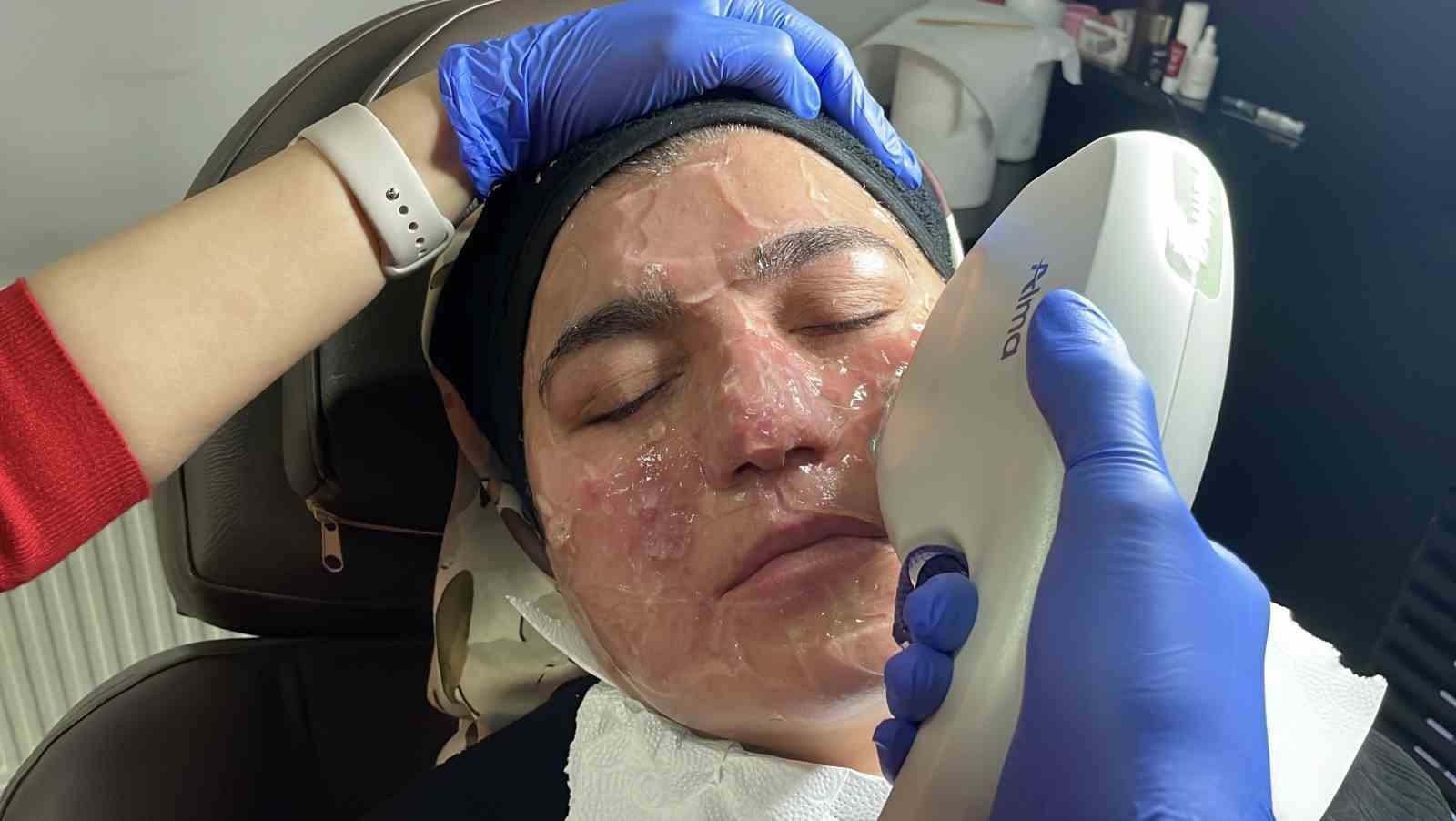 Hastalığı yüzünden yıllarca evden çıkamadı, şimdi ise çekinmeden çıkabiliyor
