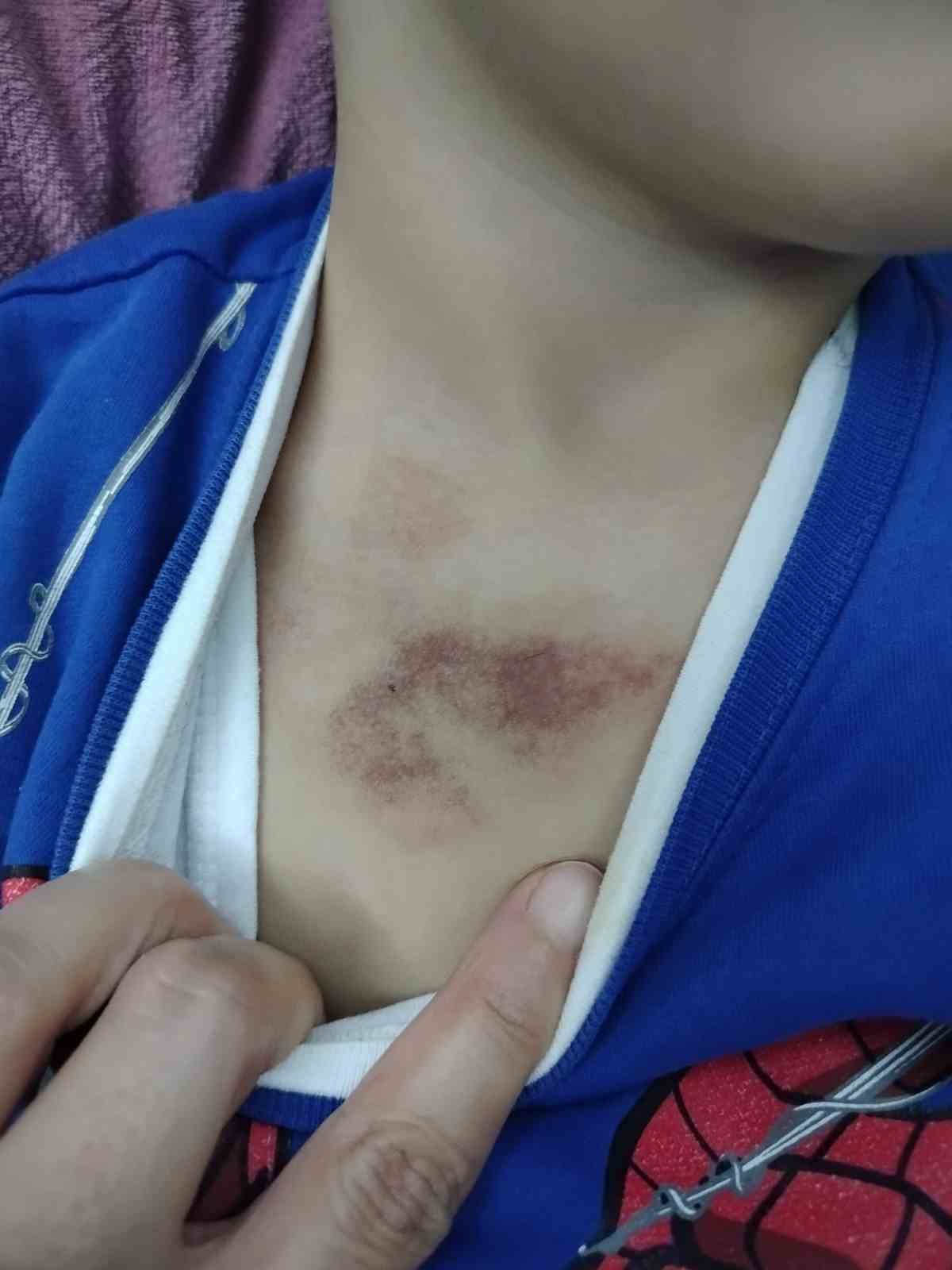 İBB kreşinde istismar ve darp iddiası: Çocukları tacize uğrayan aile şikayetçi oldu
