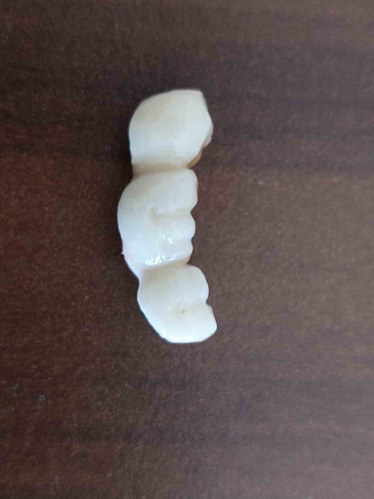 İmplant elinde hasta şikayette
