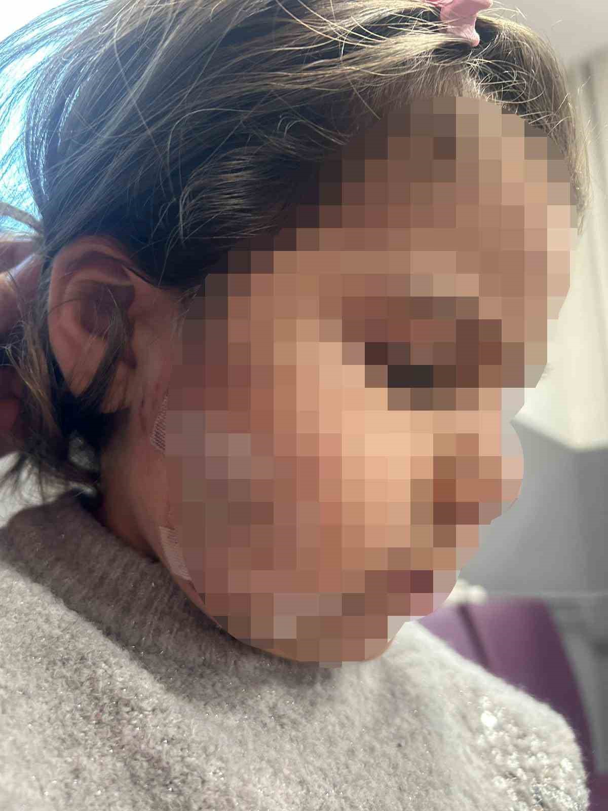 İzmir’de köpek dehşeti: 3 yaşındaki Ada’nın yüzü pençe ve ısırıkla dolu
İzmir’de köpek dehşeti: 3 yaşındaki Ada’nın yüzü pençe ve ısırıkla dolu