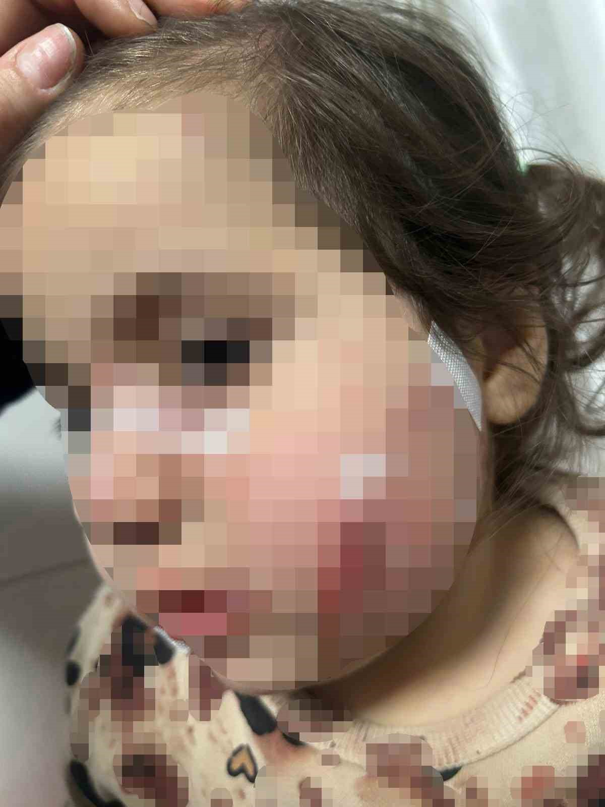 İzmir’de köpek dehşeti: 3 yaşındaki Ada’nın yüzü pençe ve ısırıkla dolu
İzmir’de köpek dehşeti: 3 yaşındaki Ada’nın yüzü pençe ve ısırıkla dolu