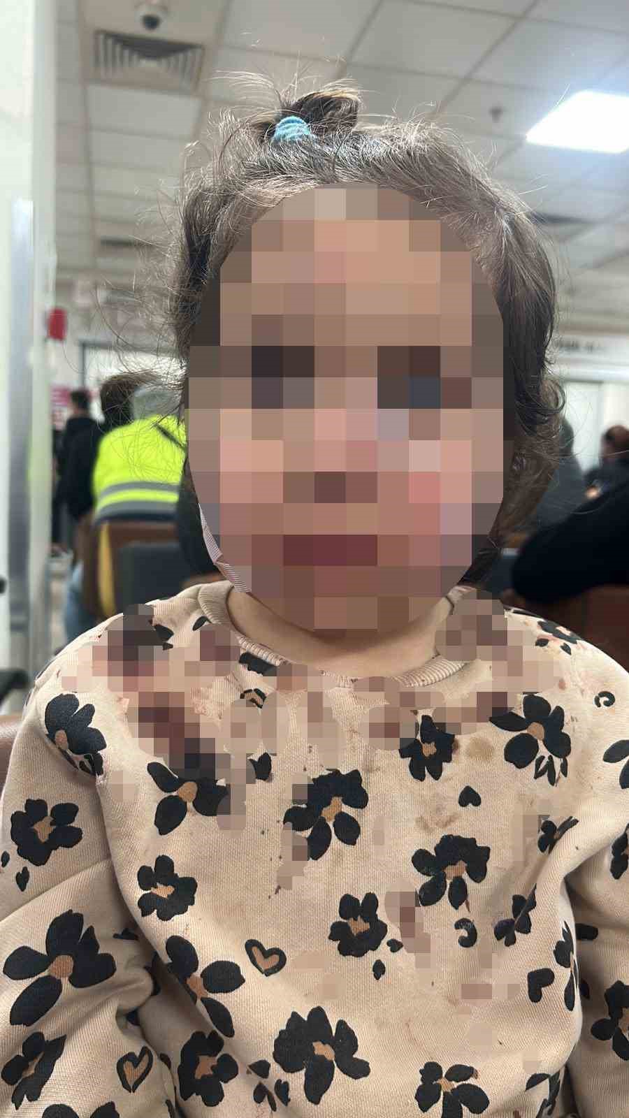 İzmir’de köpek dehşeti: 3 yaşındaki Ada’nın yüzü pençe ve ısırıkla dolu
İzmir’de köpek dehşeti: 3 yaşındaki Ada’nın yüzü pençe ve ısırıkla dolu