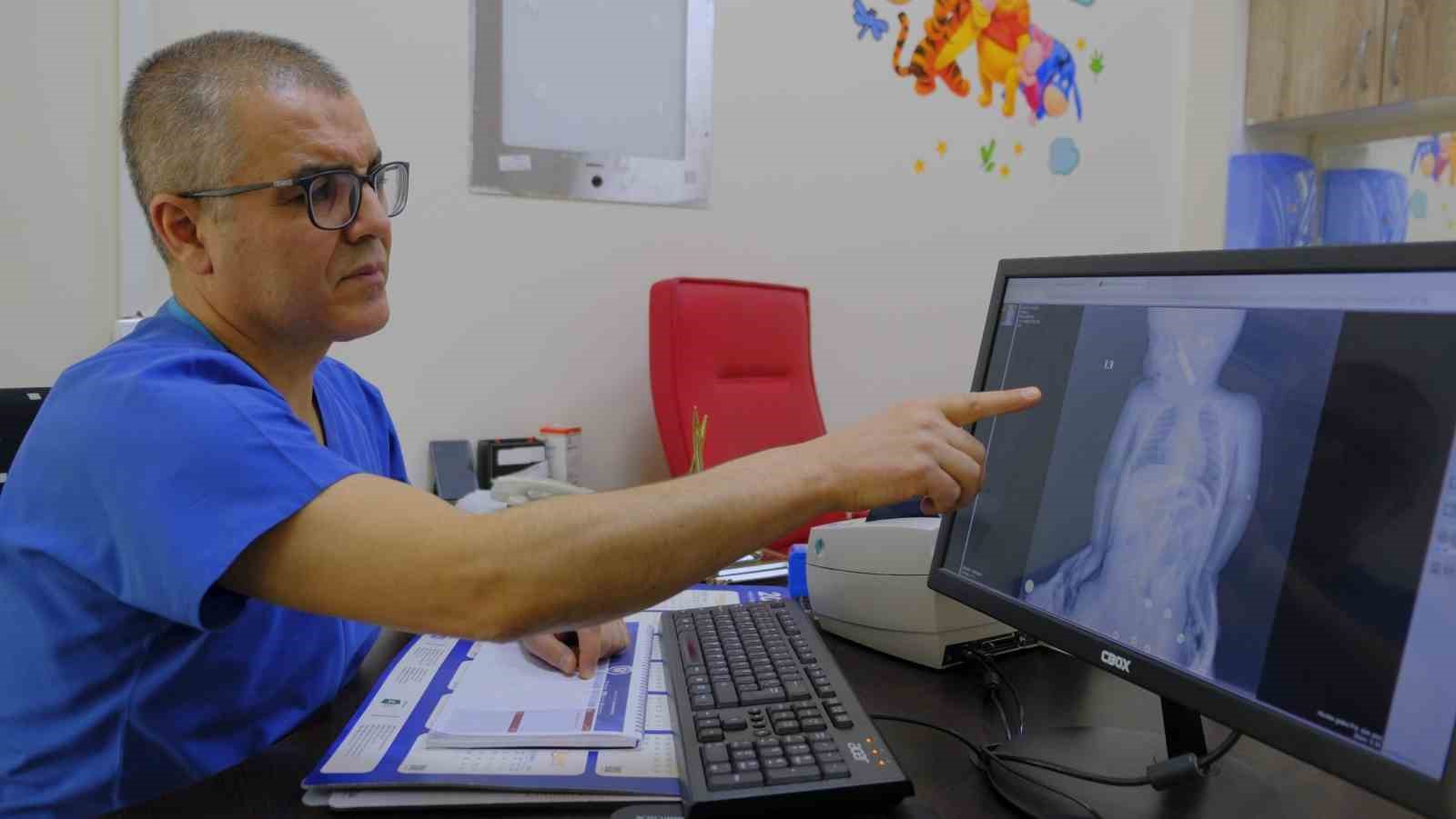 Karaman’da boğazına kumanda pili kalan kaçan bebek ölümden döndü
Karaman’da boğazına kumanda pili kalan kaçan bebek ölümden döndü