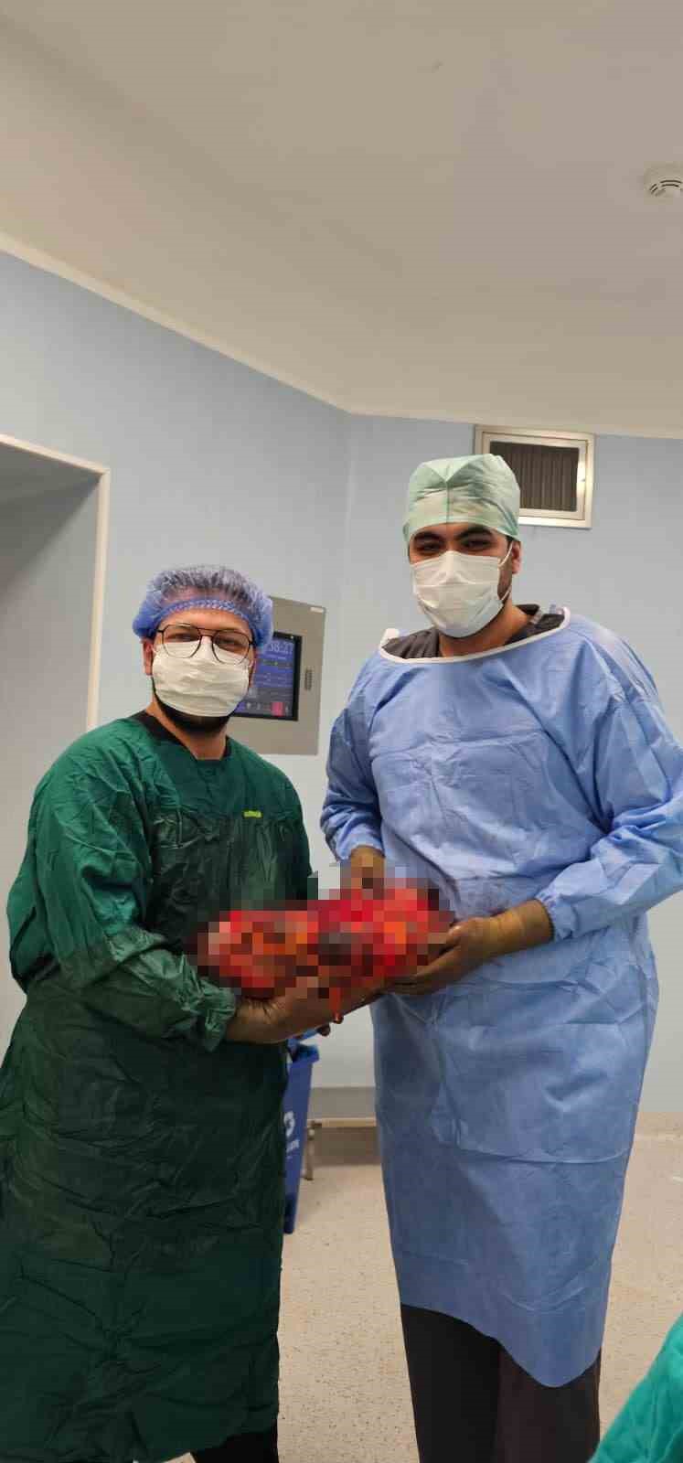 Karnında 8 kiloluk böbrekle yaşayan hasta, 30 dakikalık ameliyatla sağlığına kavuştu
