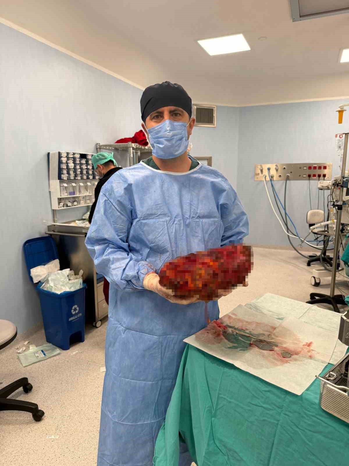 Karnında 8 kiloluk böbrekle yaşayan hasta, 30 dakikalık ameliyatla sağlığına kavuştu
