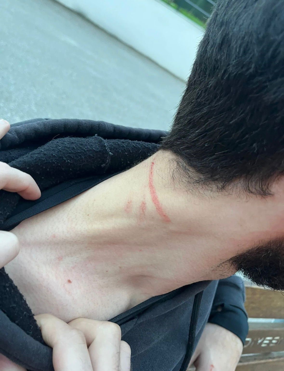 Kartepe’deki kavganın en büyük mağduru çocuklar oldu: "Babama 5 kişi saldırdılar, kafasını ATV’ye vurdular"
