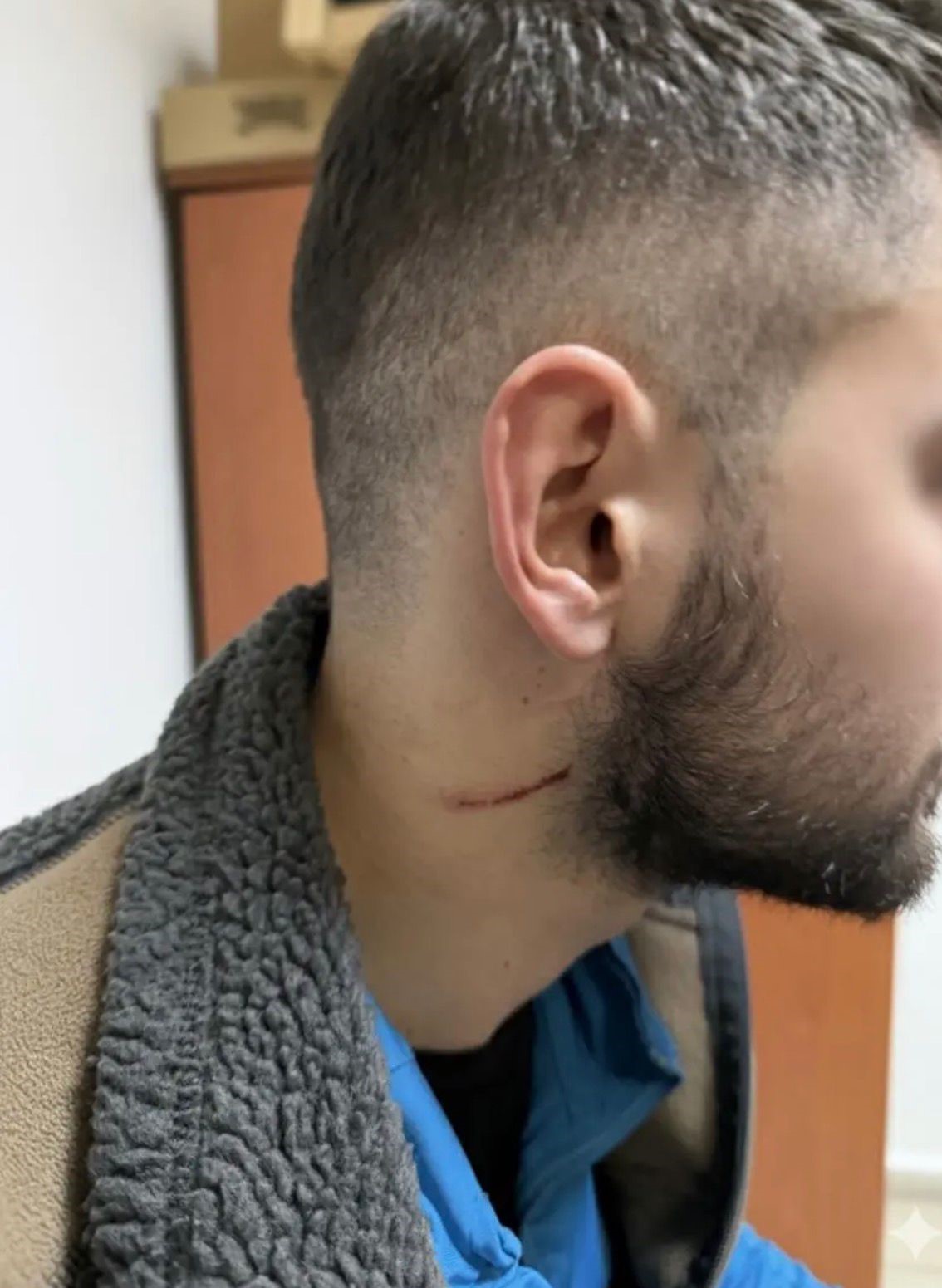 Kartepe’deki kavganın en büyük mağduru çocuklar oldu: "Babama 5 kişi saldırdılar, kafasını ATV’ye vurdular"
