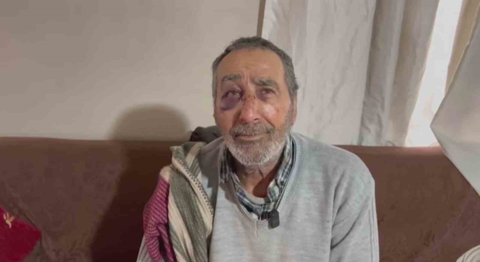 Kazaların eksik olmadığı yola muhtar ve yaralı vatandaş çözüm istedi
