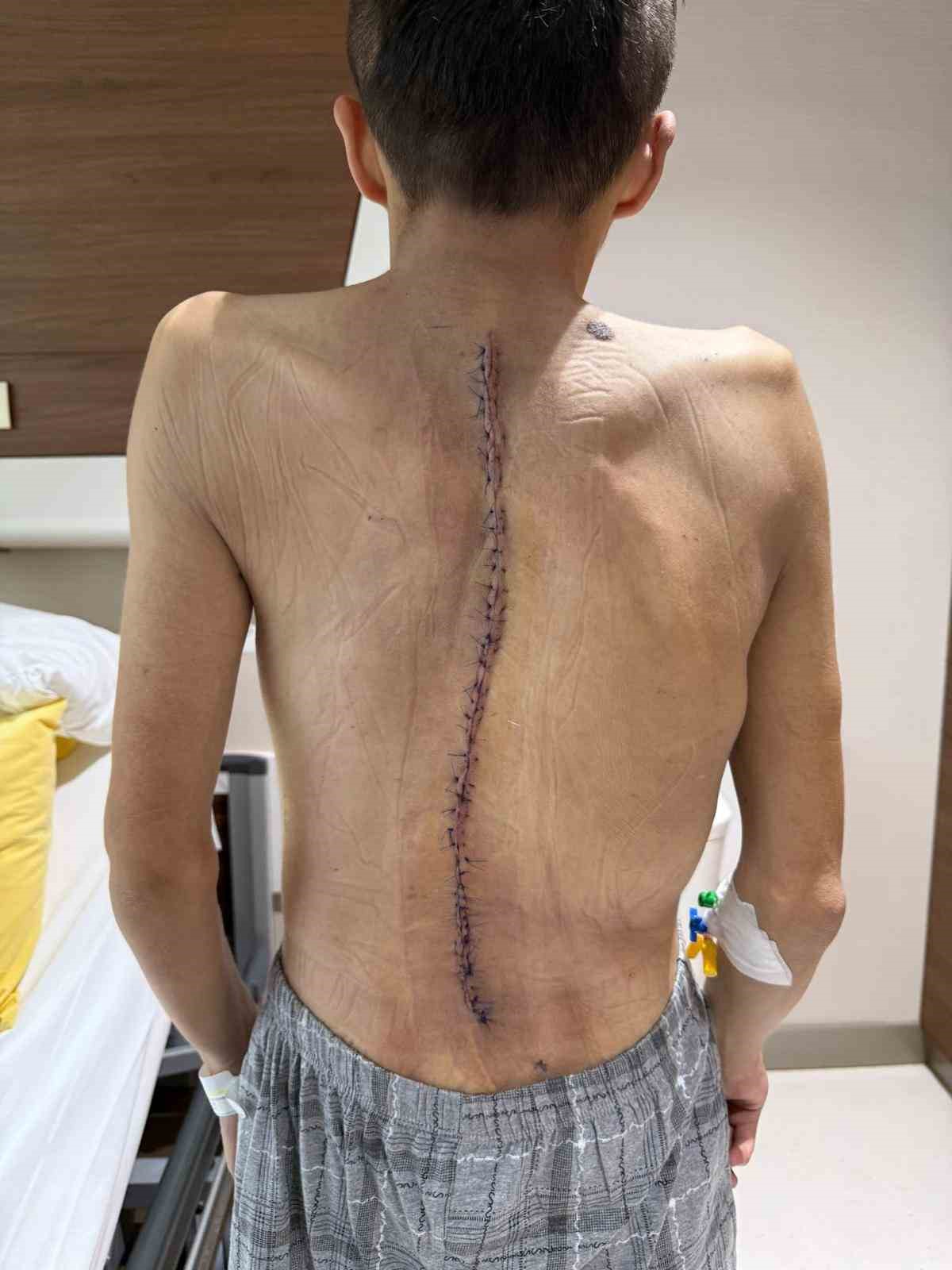 Kırgızistanlı genç şifayı Türk hekimlerinde buldu
