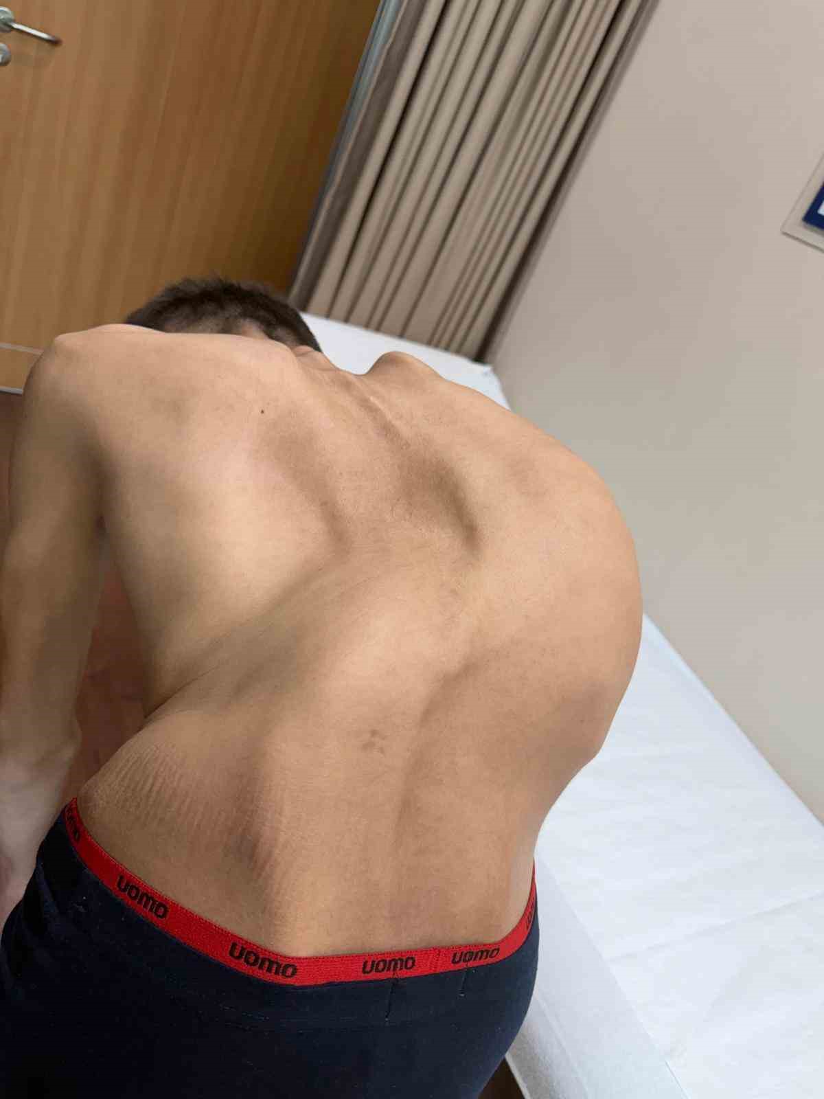 Kırgızistanlı genç şifayı Türk hekimlerinde buldu
