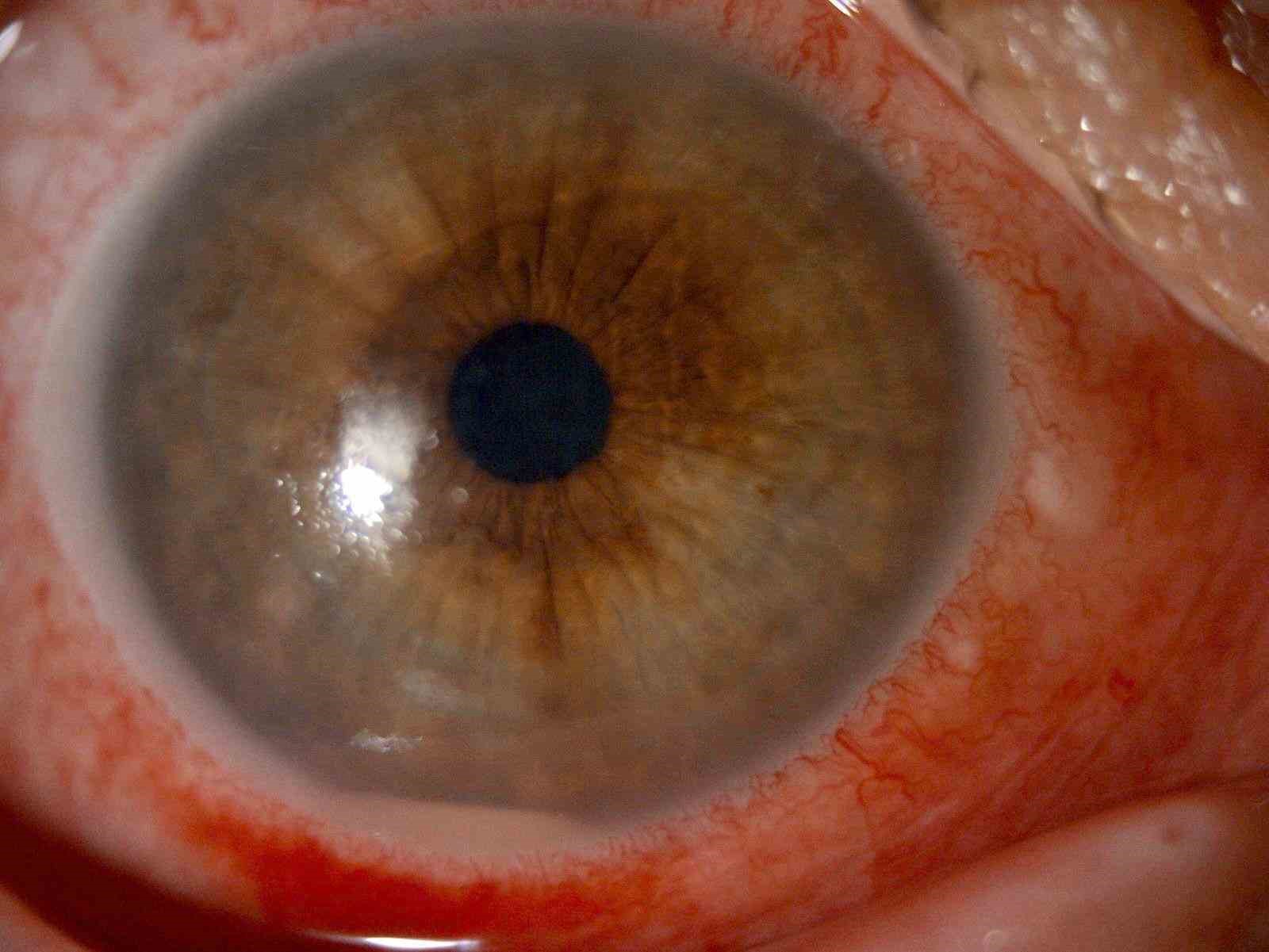 ’Kırlangıç otu kullanımı’na dikkat, uzmanlar uyarıyor: "Gözlerine suyunu damlattı, göremez hale geldi"
’Kırlangıç otu kullanımı’na dikkat, uzmanlar uyarıyor: "Gözlerine suyunu damlattı, göremez hale geldi"