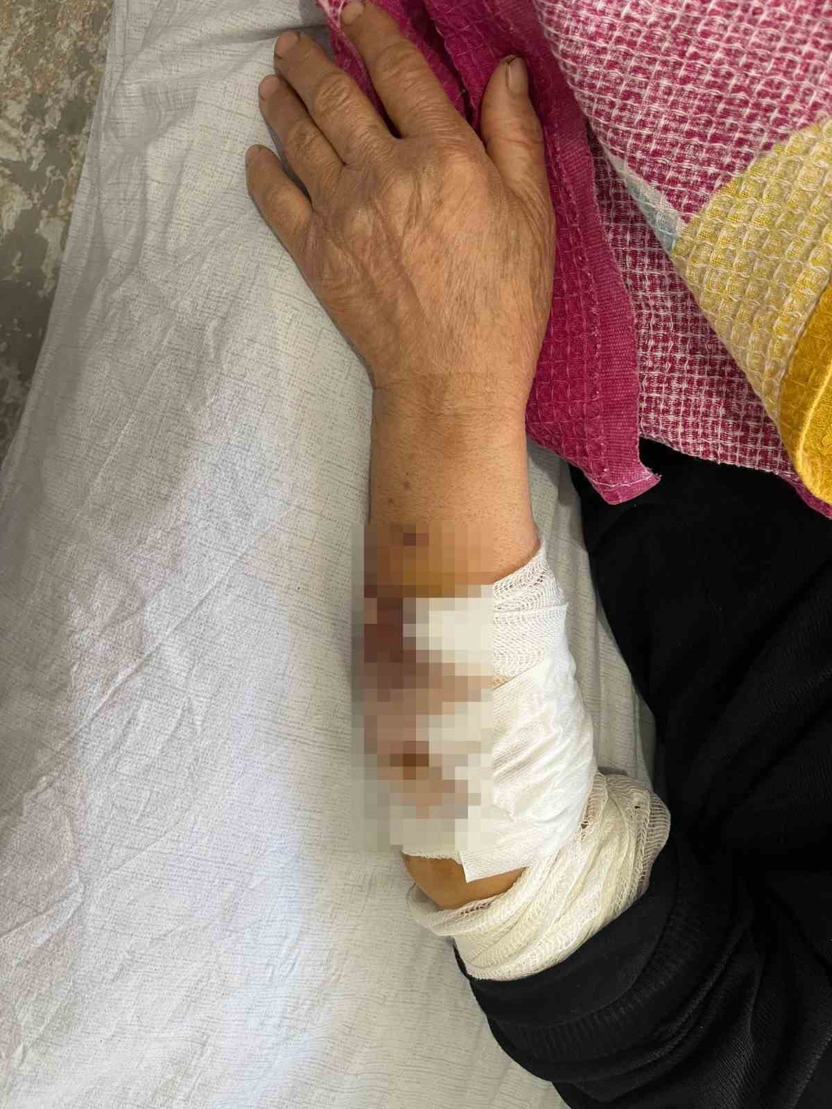 Köpek sürüsünün saldırısında ağır yaralanan yaşlı kadın: "Kolumu, elimi, başımı ve bacağımı parçaladılar"
